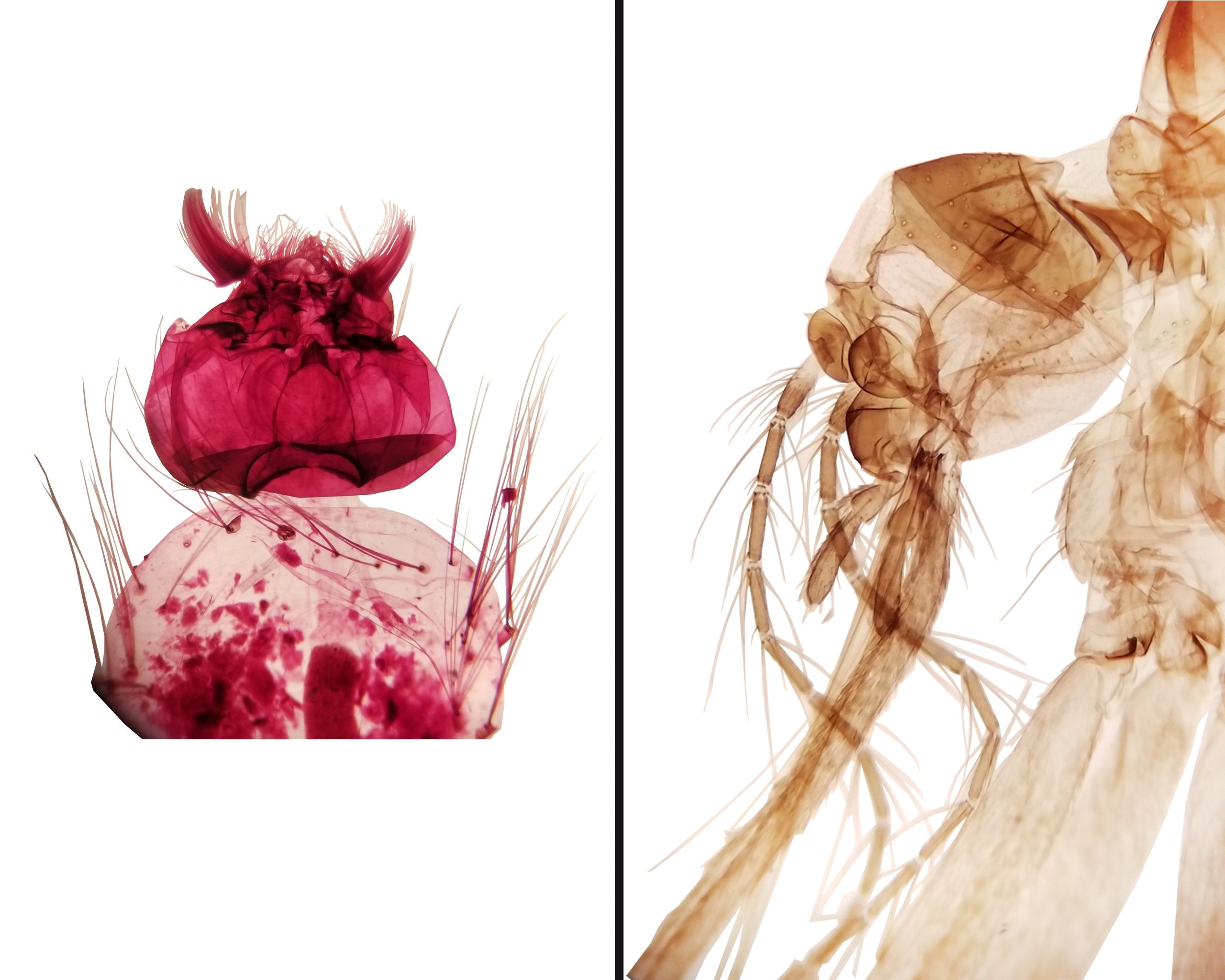 Zika as a Cancer Treatment?