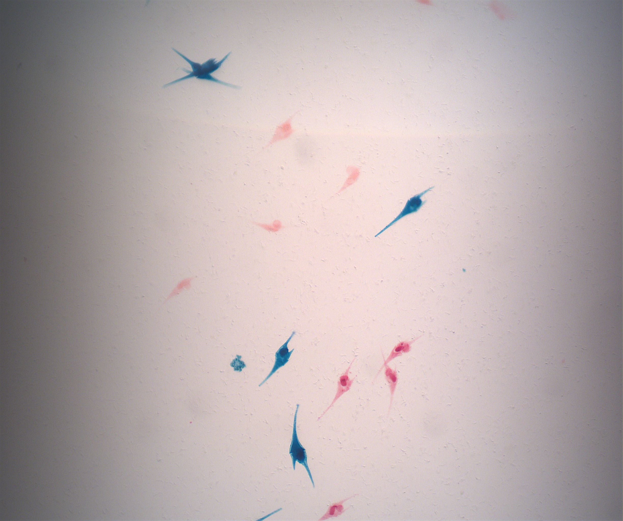 Prepared Slide, Dinoflagellate, Peridinium, W.M.