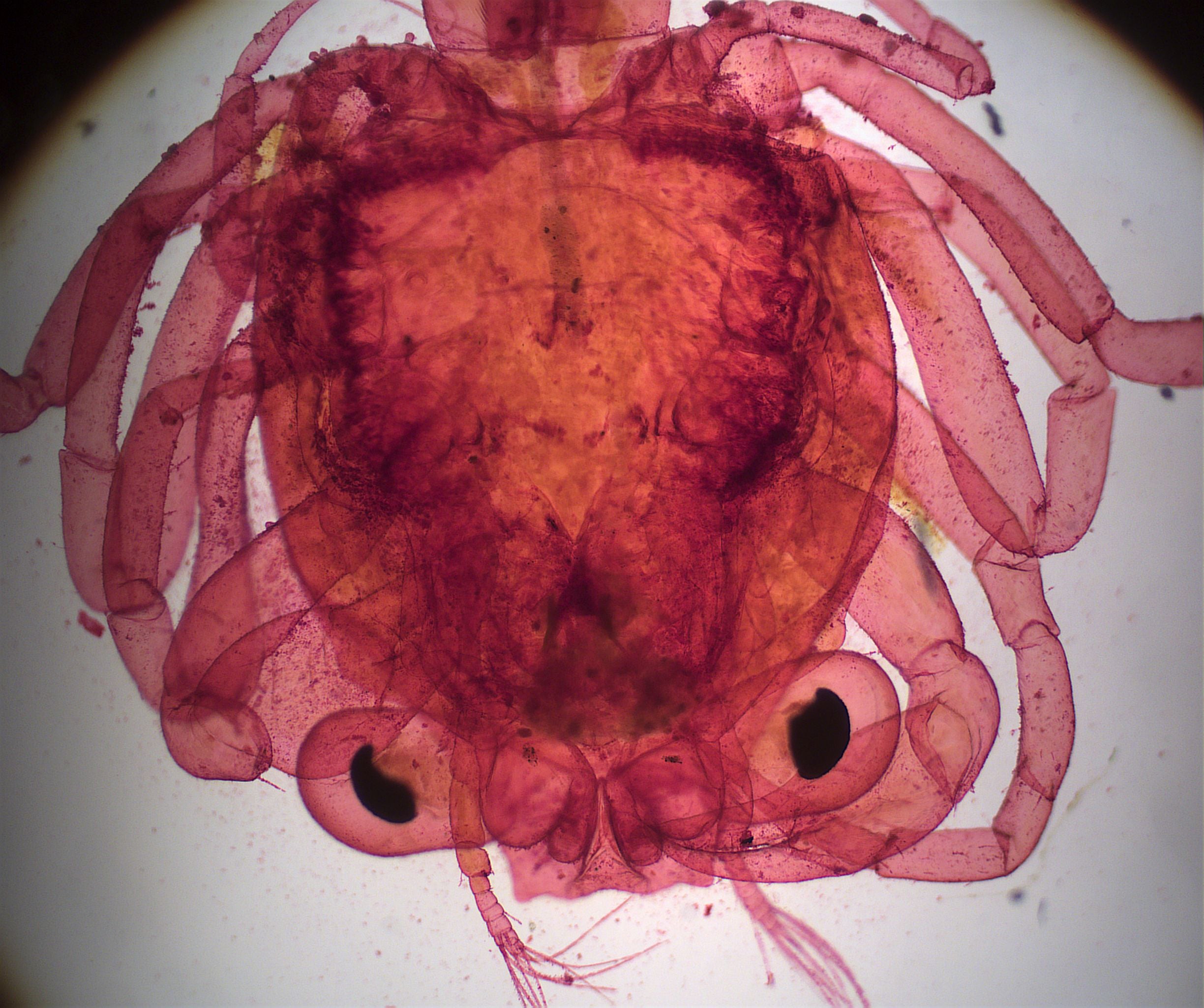 Prepared Slide, Crab Zoea