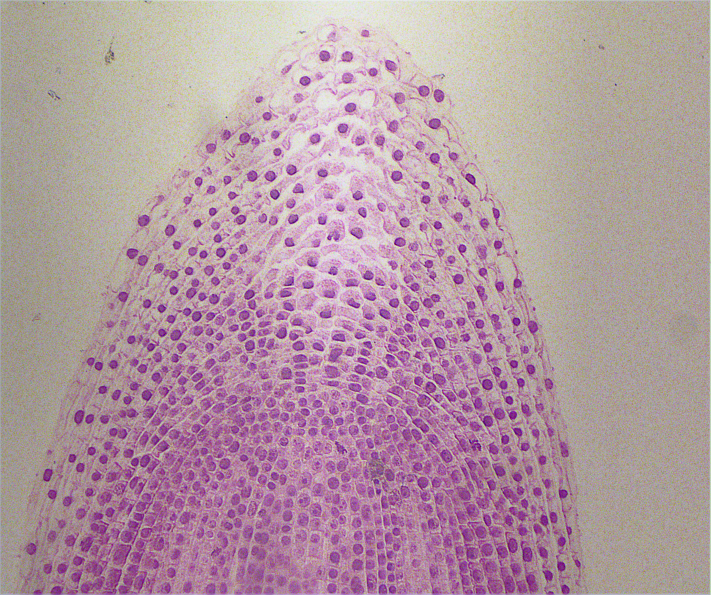 Onion Mitosis; Showing All Stages; Lateral Section