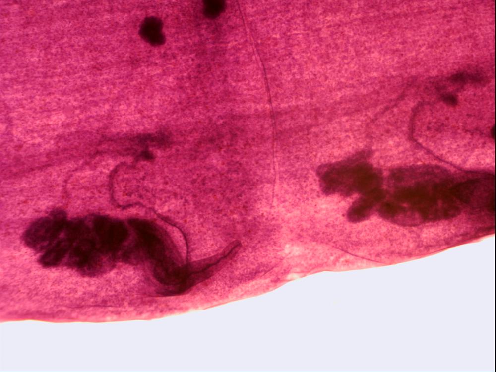 Taenia Immature Proglottid, from cow or sheep.