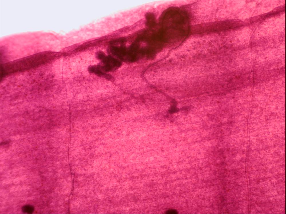 Taenia Immature Proglottid, from cow or sheep.