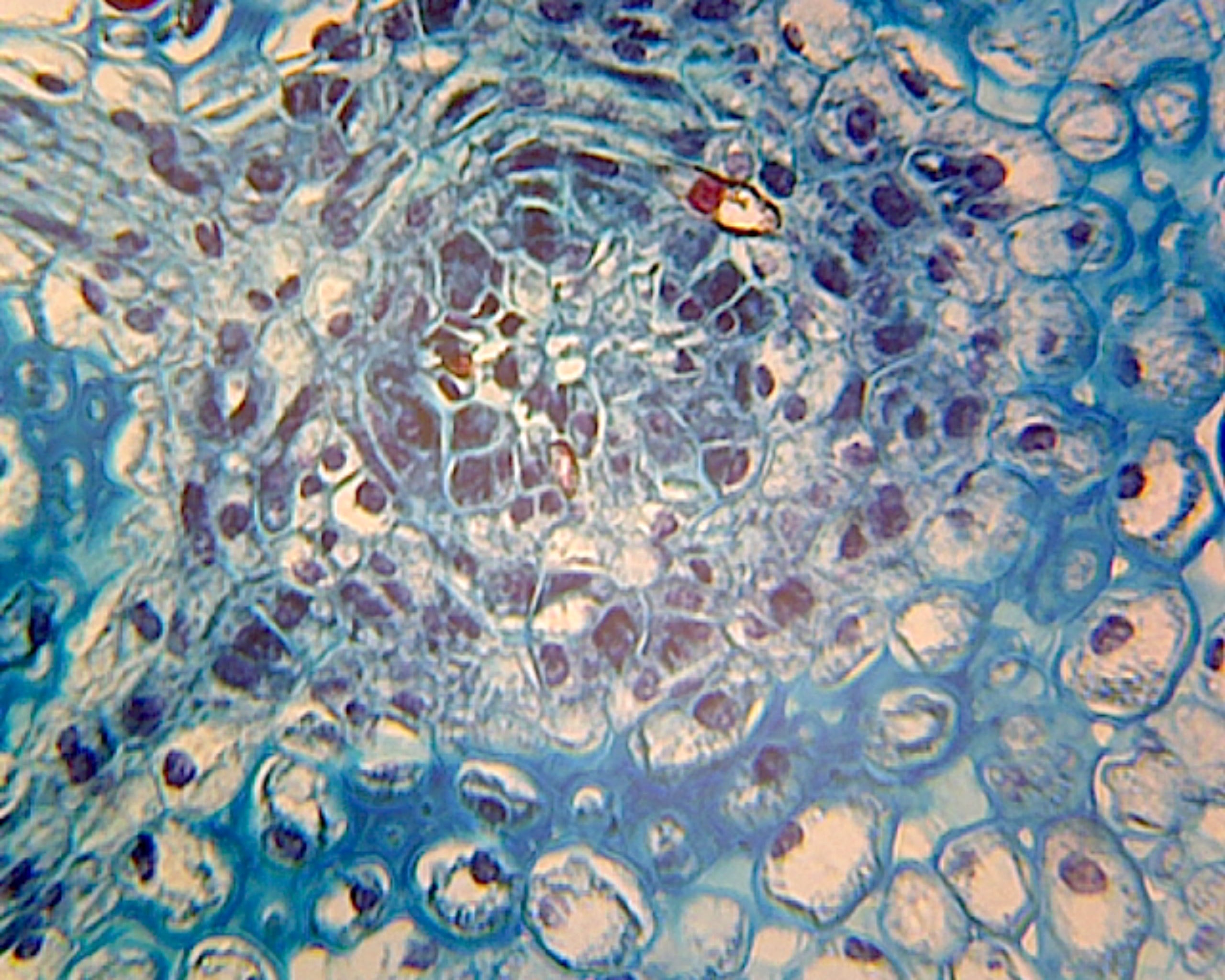 Elodea Stem Tip; Cross Section