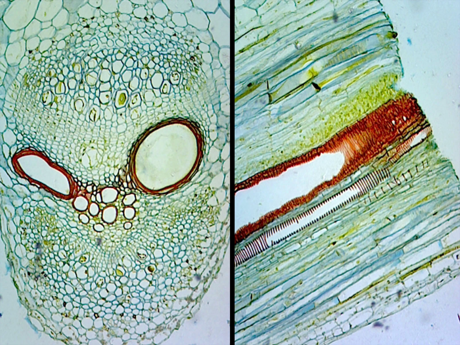 Pumpkin (Cucurbita) Stem; Typical Dicot Stem; Cross Section and Longitudinal Section