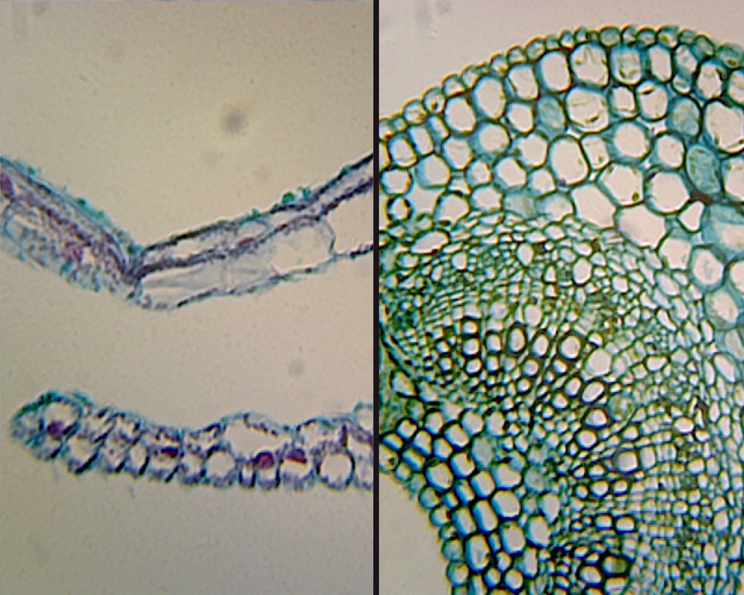 Slide, Angiosperm Leaf; Air (Ligustrum) and Water (Elodea) Plant Comparison; Cross Section