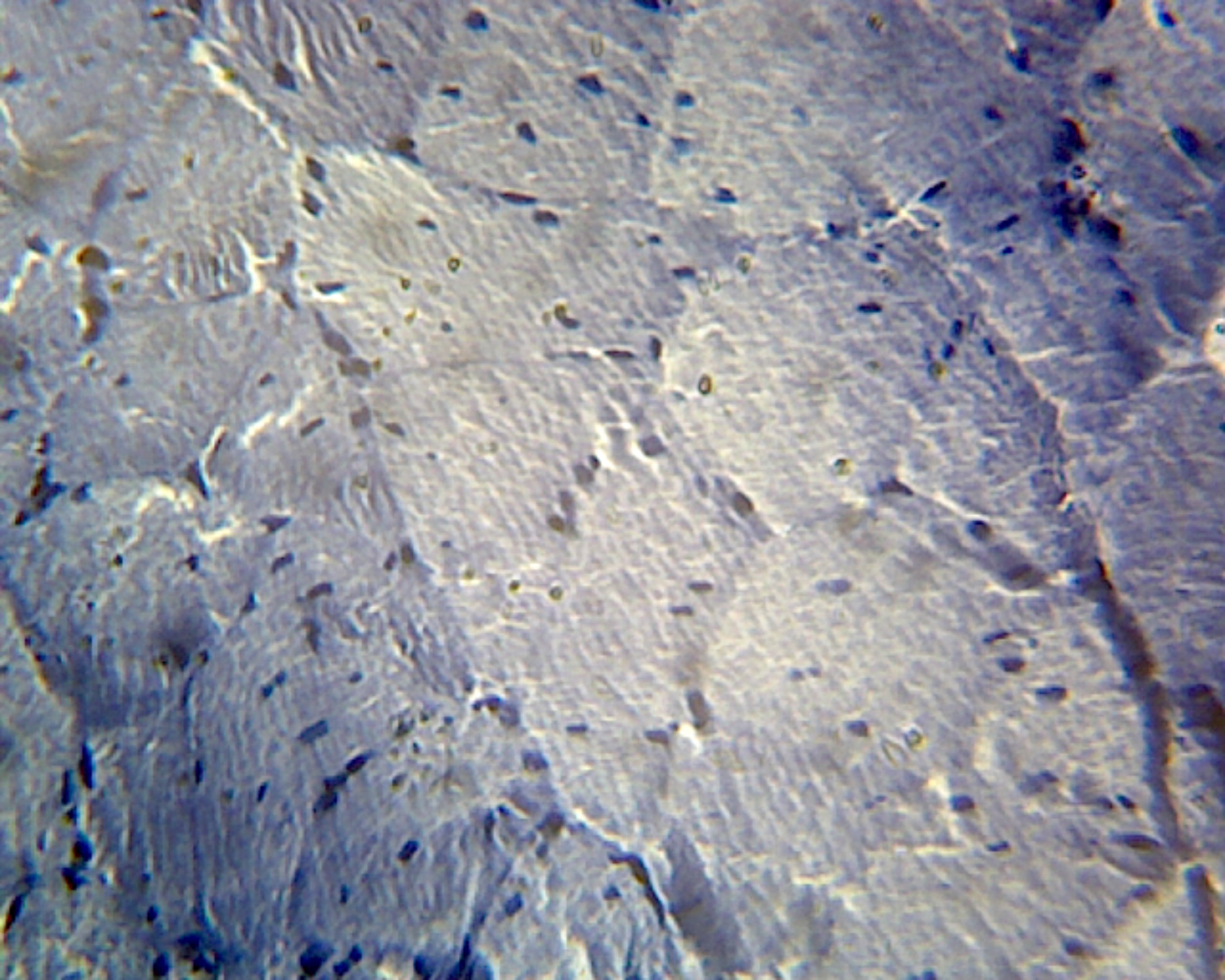 Frog Striated Skeletal Muscle; Cross Section by Go Science Crazy