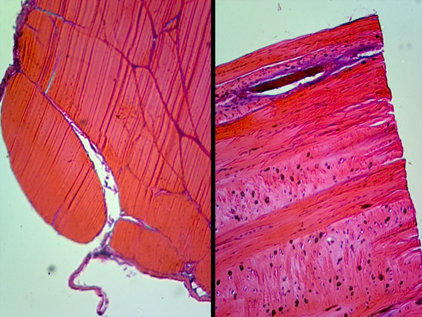 Human Tendon Composite; Cross Section and Longitudinal Section by Go Science Crazy