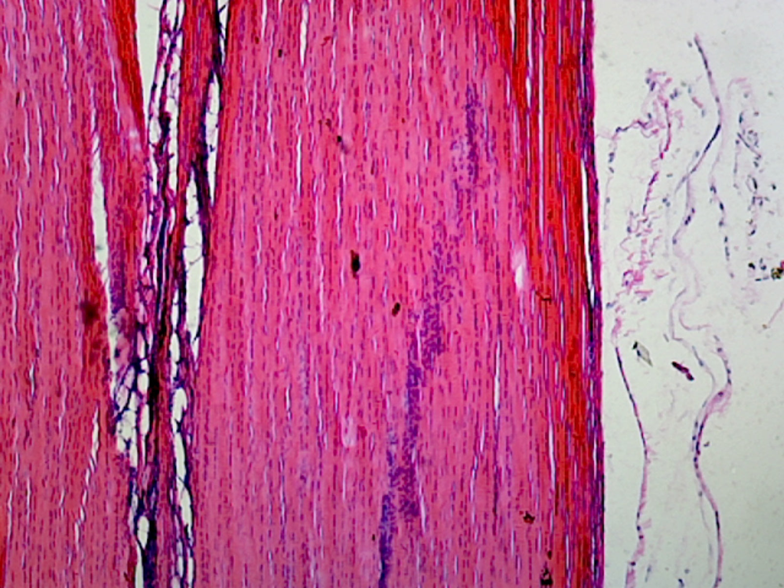 Prepared Microscope Slide Muscle-Tendon Junction, Mammalian, Longitudinal Section, H&E Stain.