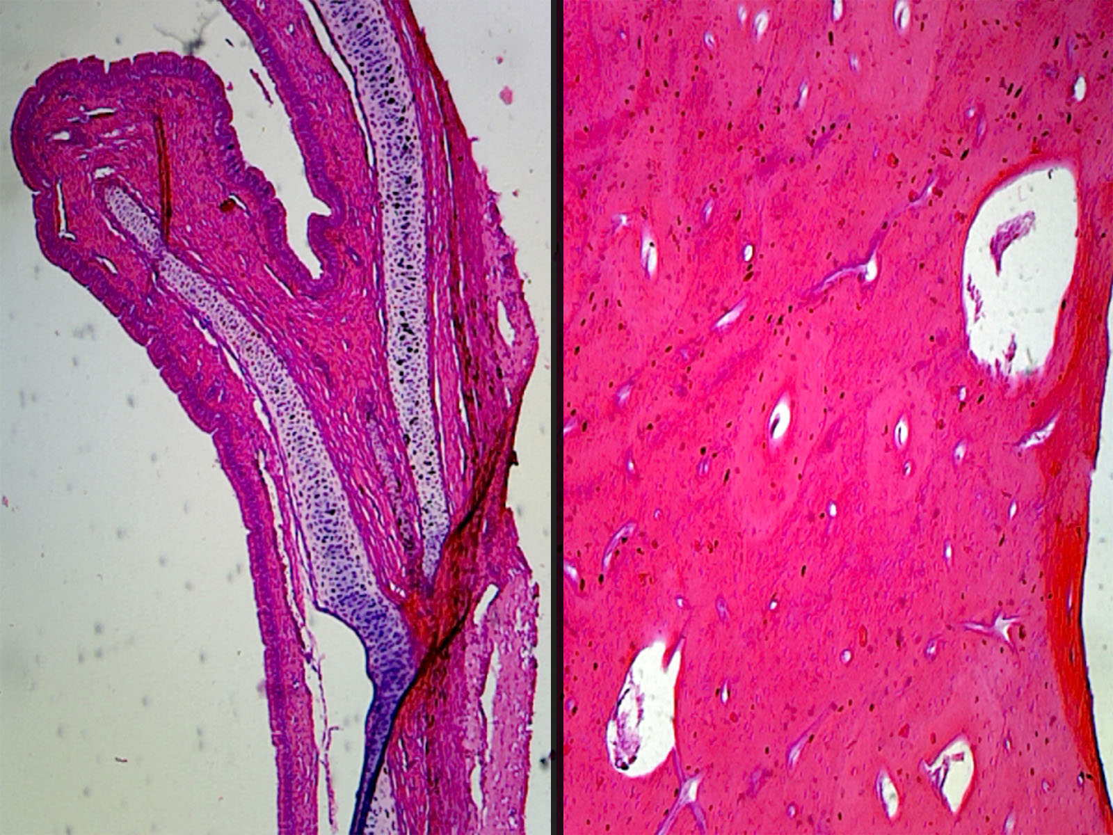 Compact Bone, Decalcified Preparation; Cross Section and Longitudinal Section