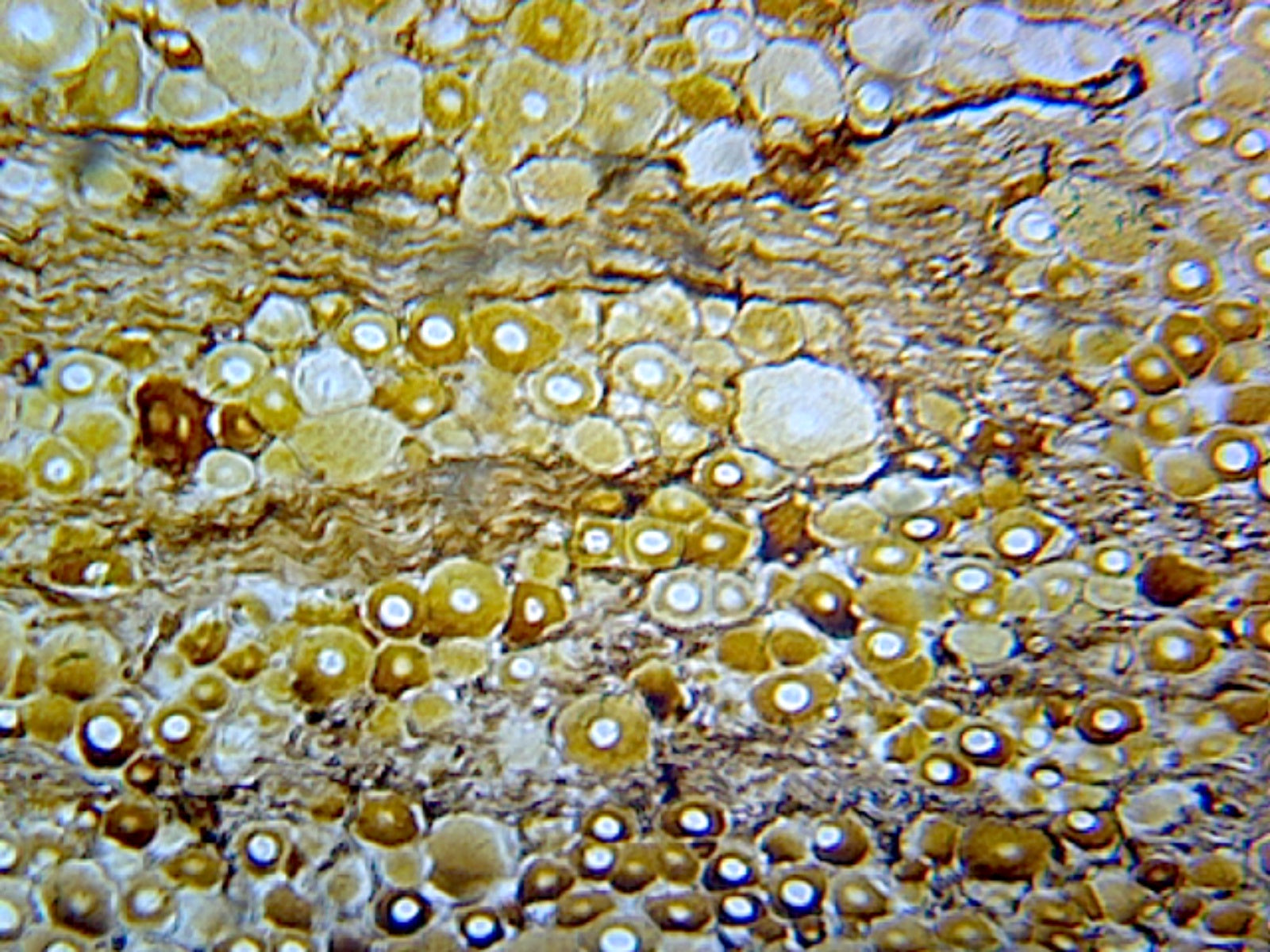 Basal Ganglion, Mammalian; Section by Go Science Crazy