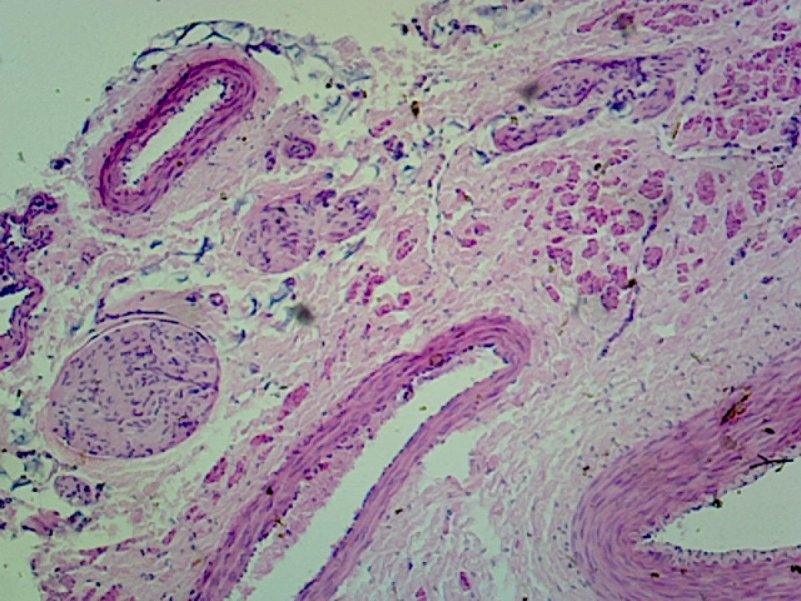Medium-Sized Artery and Vein, Human; Cross Section by Go Science Crazy