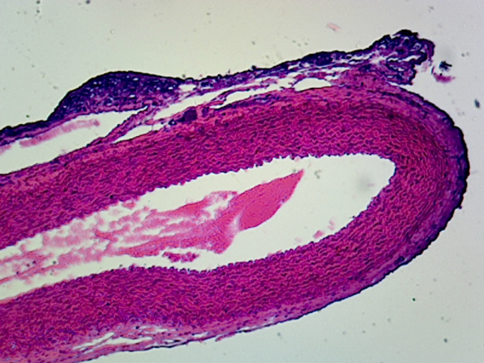 Vena Cava, Human; Cross Section