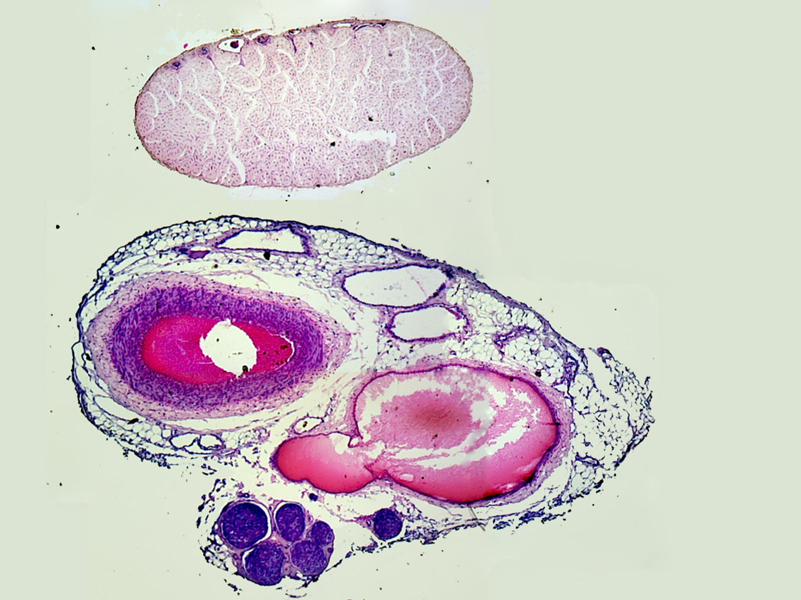 Slide, Artery, Vein, and Nerve, Mammalian; Cross Section