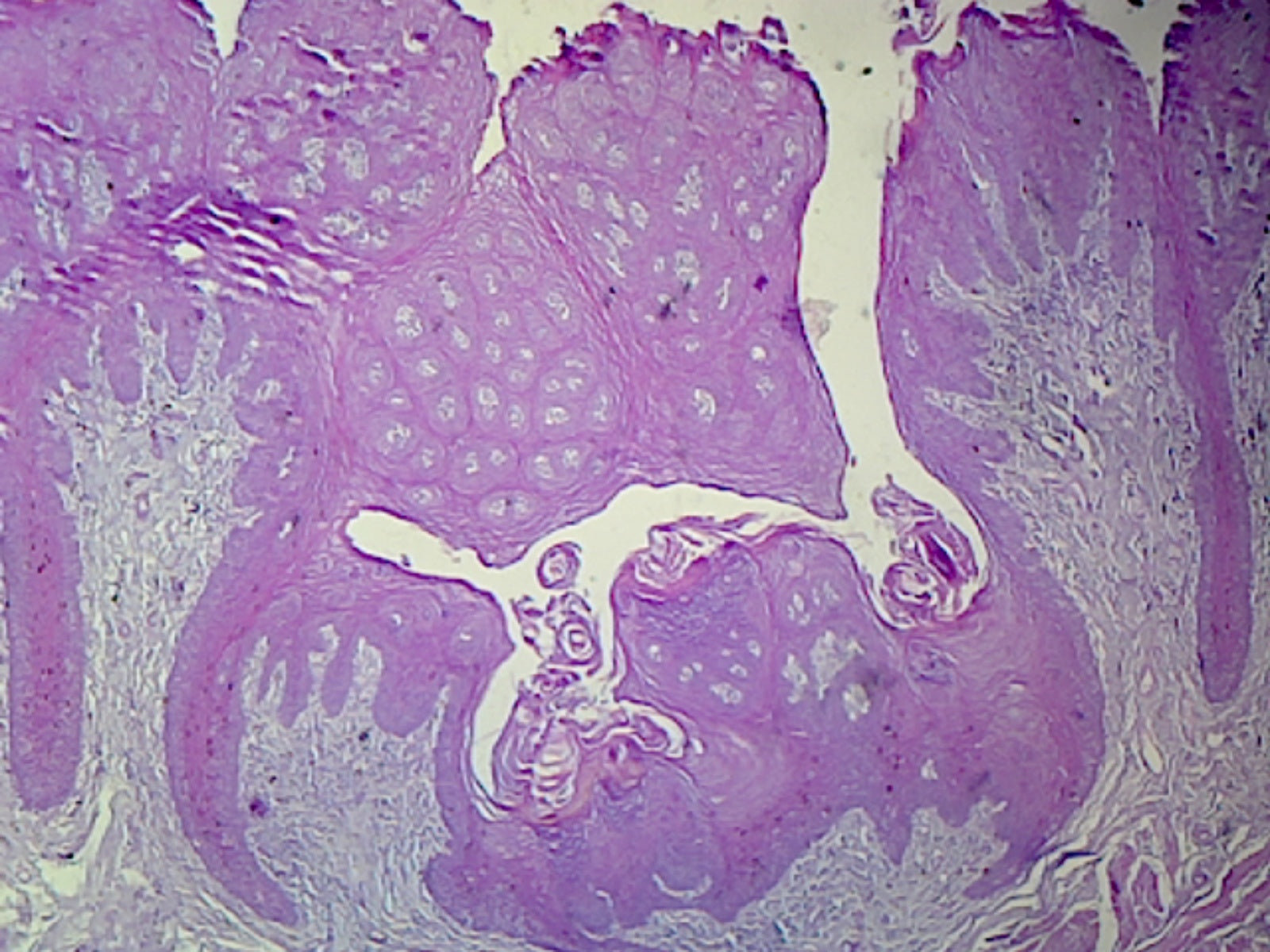 Tongue, Human; Showing General Structure; Cross Section