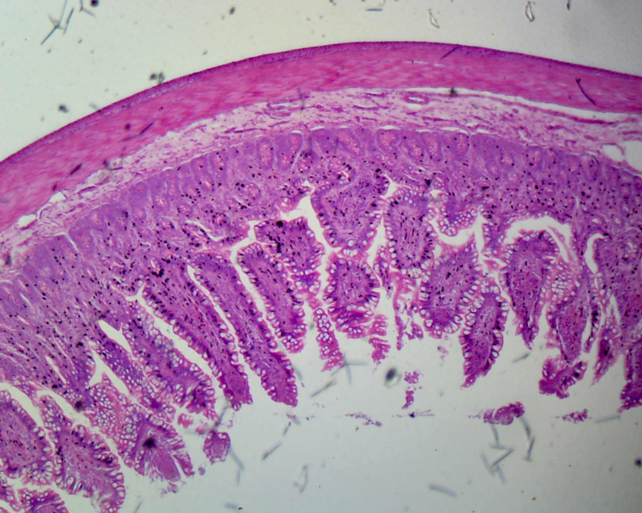 Jejunum, Human; Showing Plicae Circulares; Section