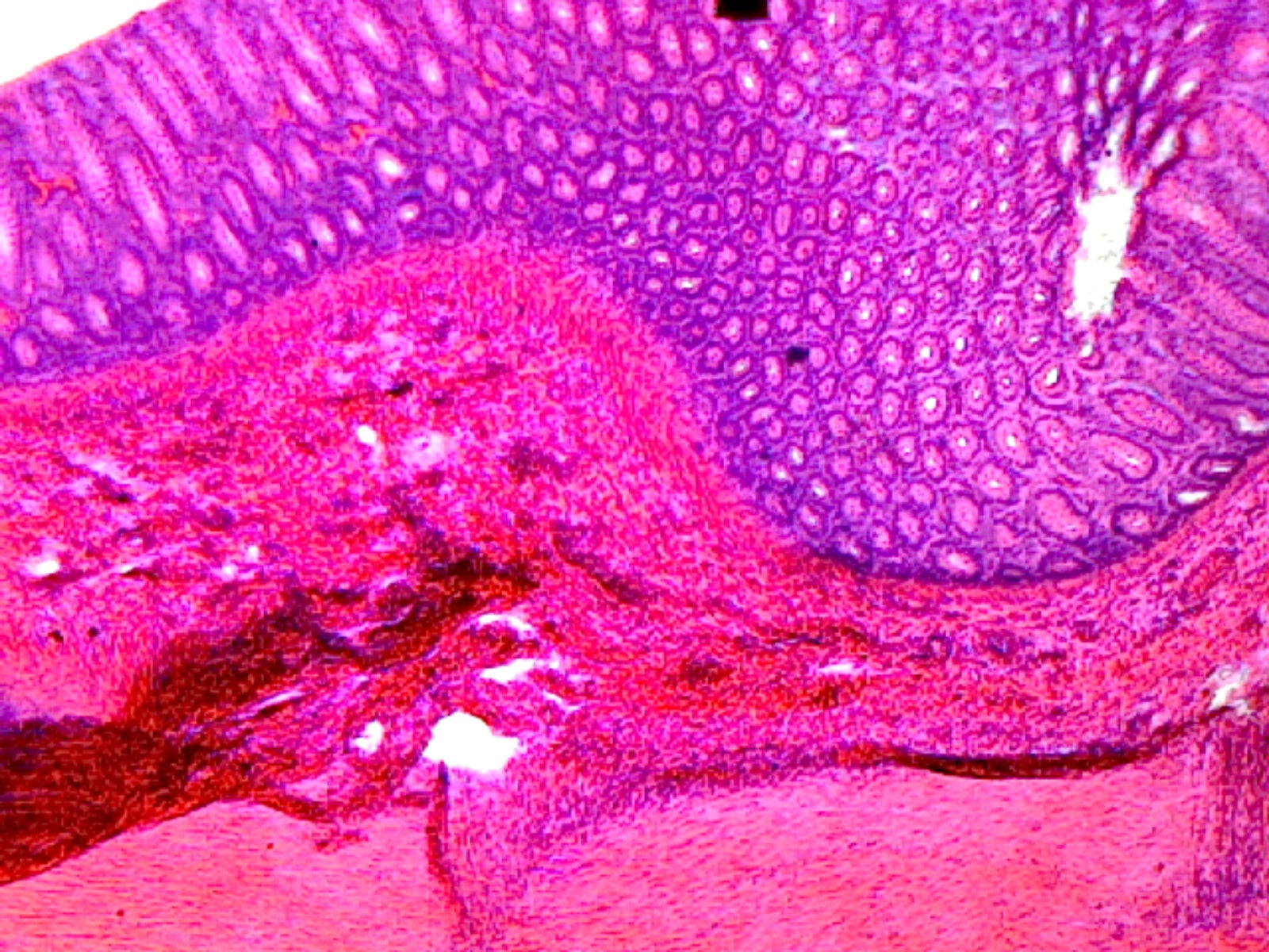 Colon, Mammalian; Showing Typical Histology Structures; Cross Section by Go Science Crazy
