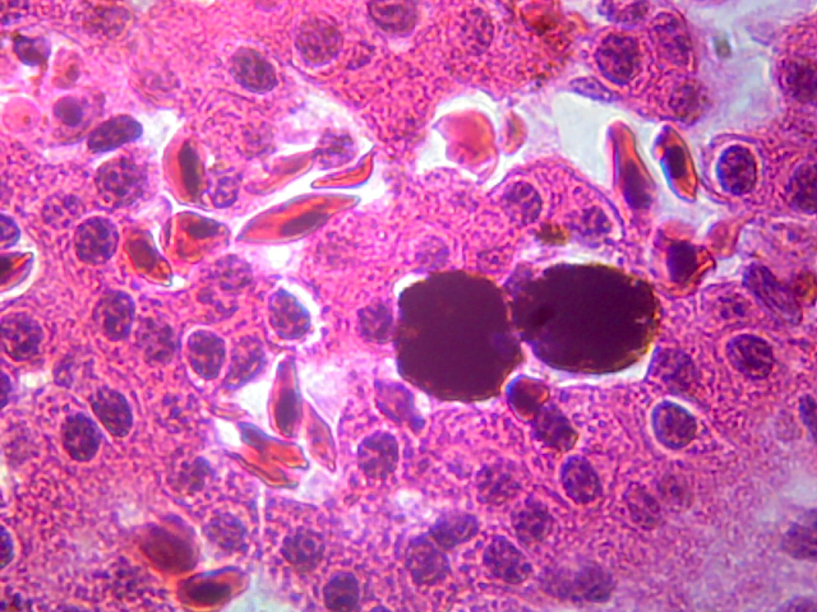 Liver, Amphiuma; Section