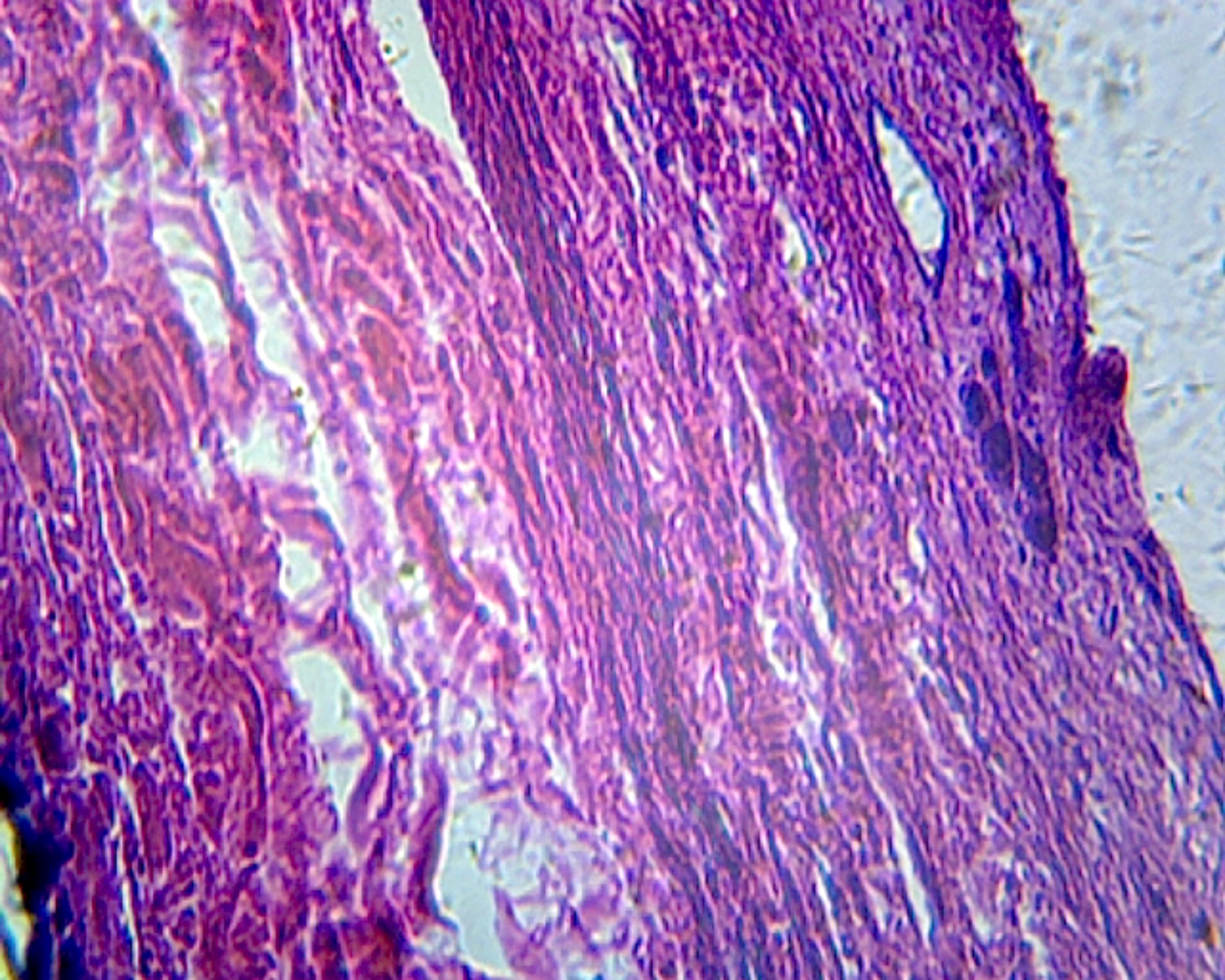 Gallbladder, Mammalian; Showing Simple Columnar Epithelium, Serosa, and Muscular Layer; Section