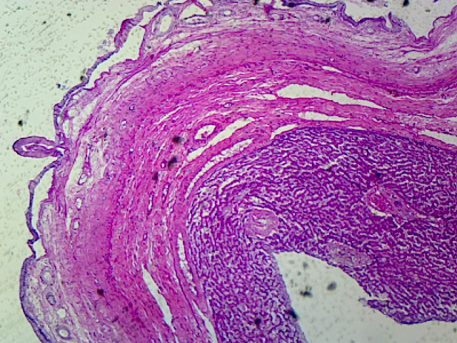 Gallbladder, Human; Showing Simple Columnar Epithelium, Serosa, and Muscular Layer; Section