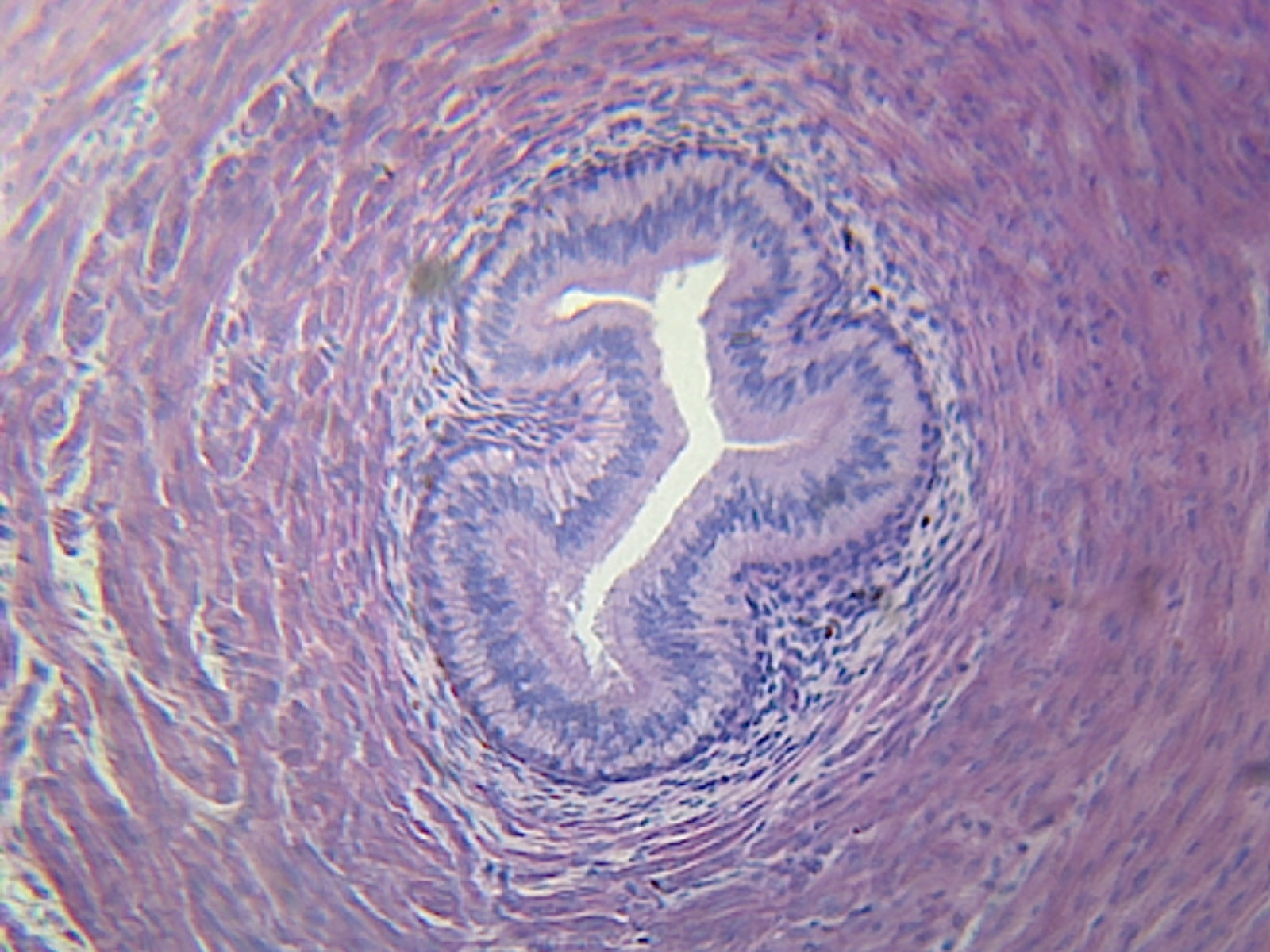 Ureter, Mammalian; Showing Tissue Layers; Cross Section