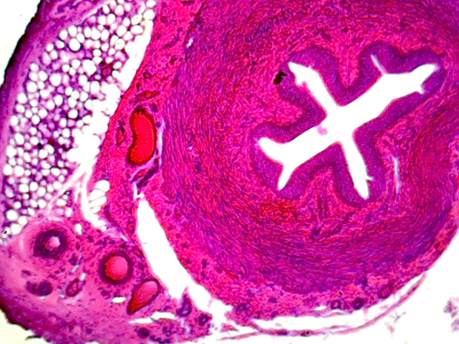 Ureter, Human; Showing Tissue Layers; Cross Section