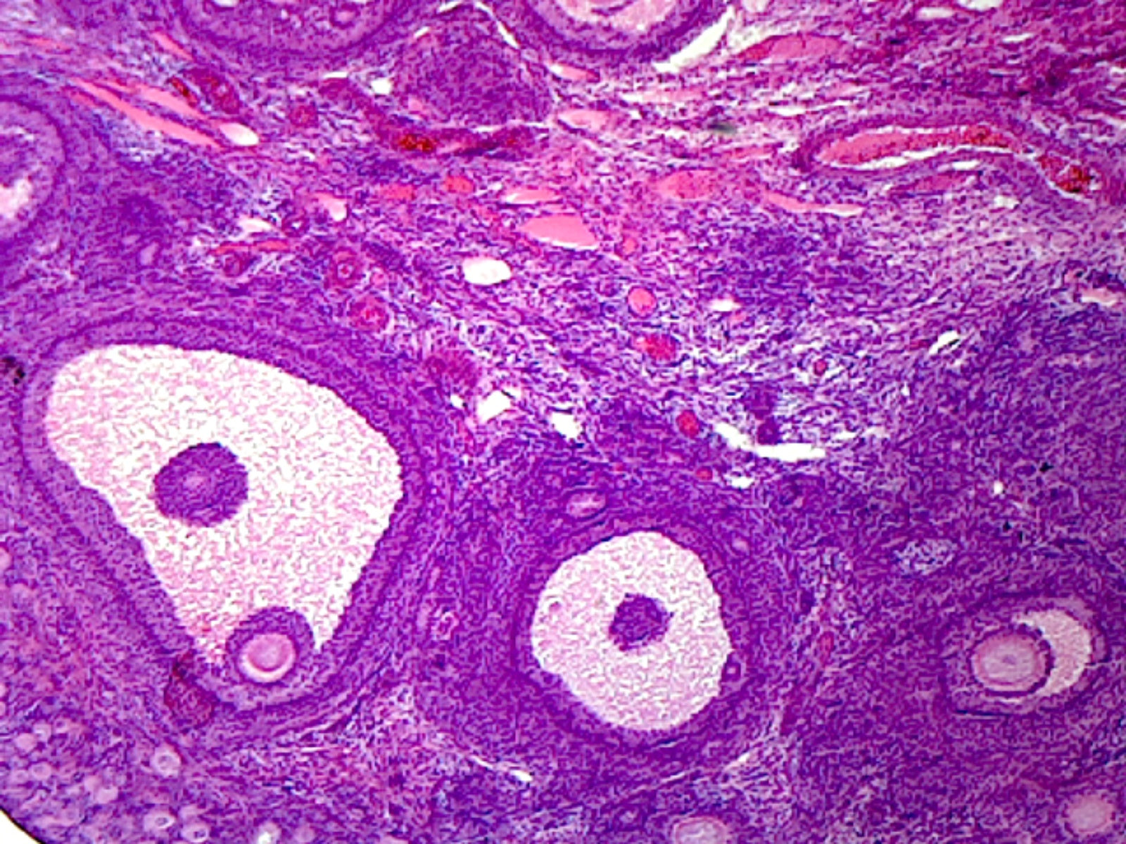 Mature Ovary, Mammalian; Showing General Structures; Section; M Stain by Go Science Crazy