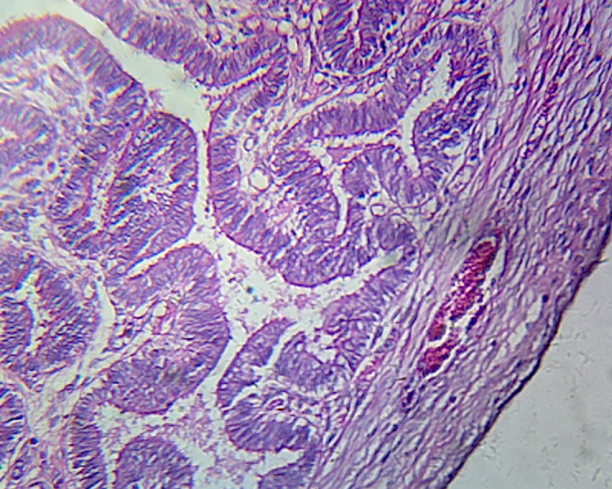 Fallopian Tube, Human; Showing General Oviduct Structure; Cross Section by Go Science Crazy
