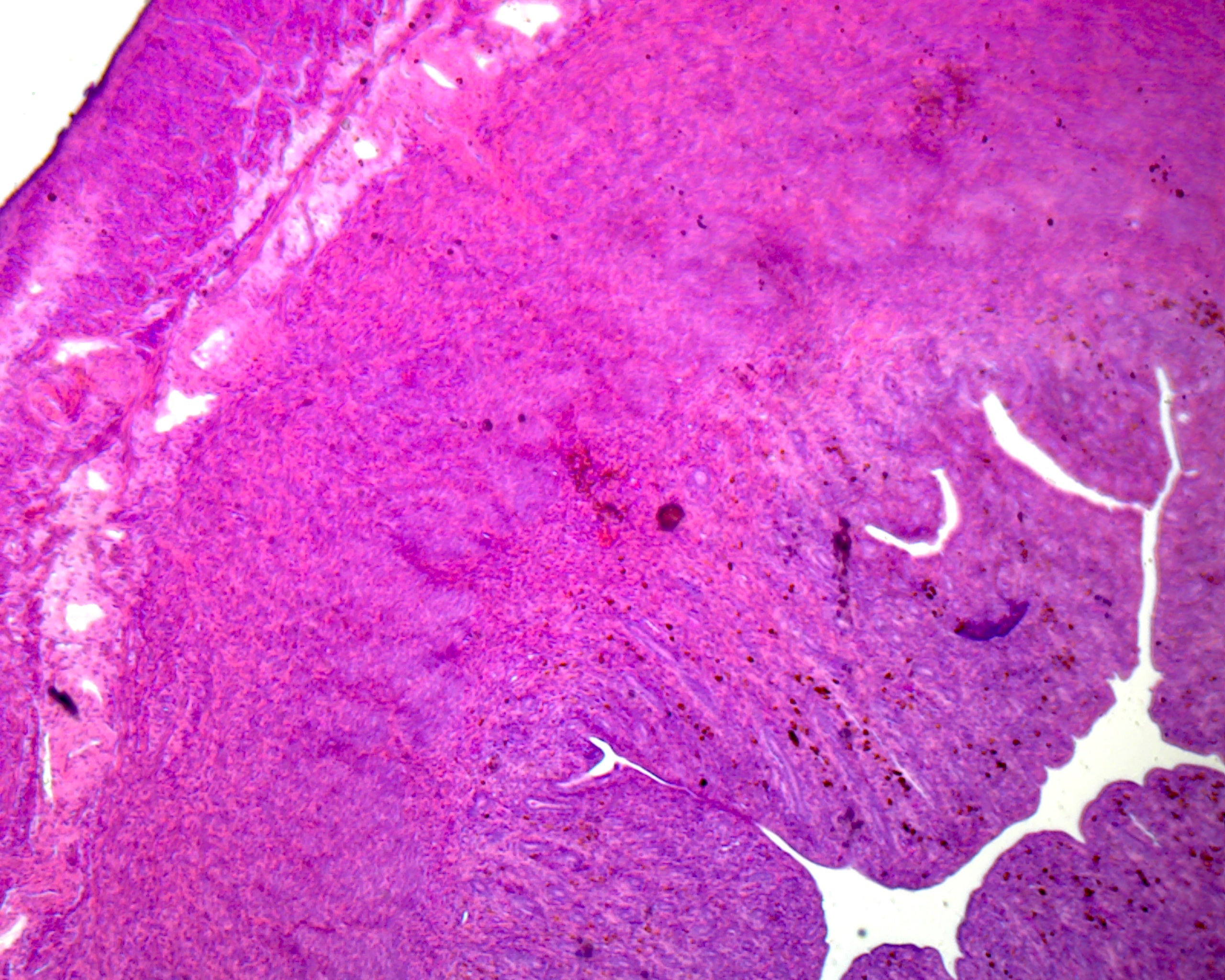 Uterus, Human; Showing General Structure; Section