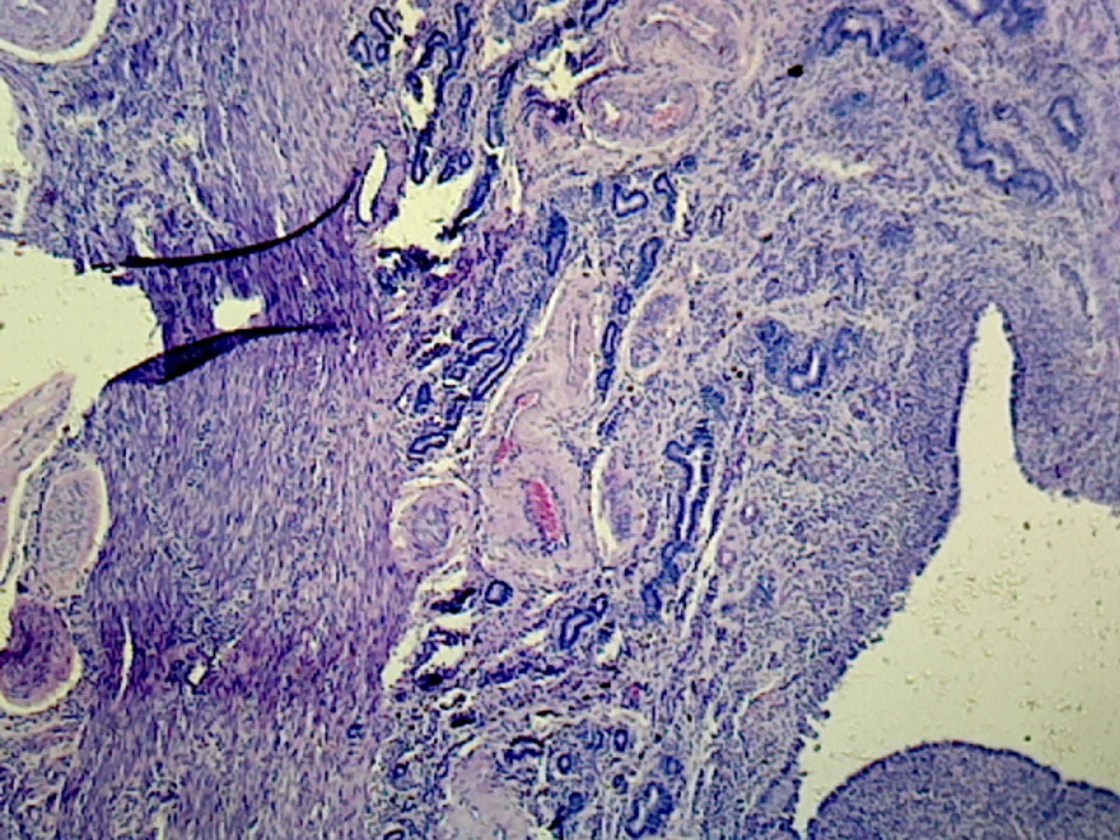 Uterus in Secretory Phase, Human; Section