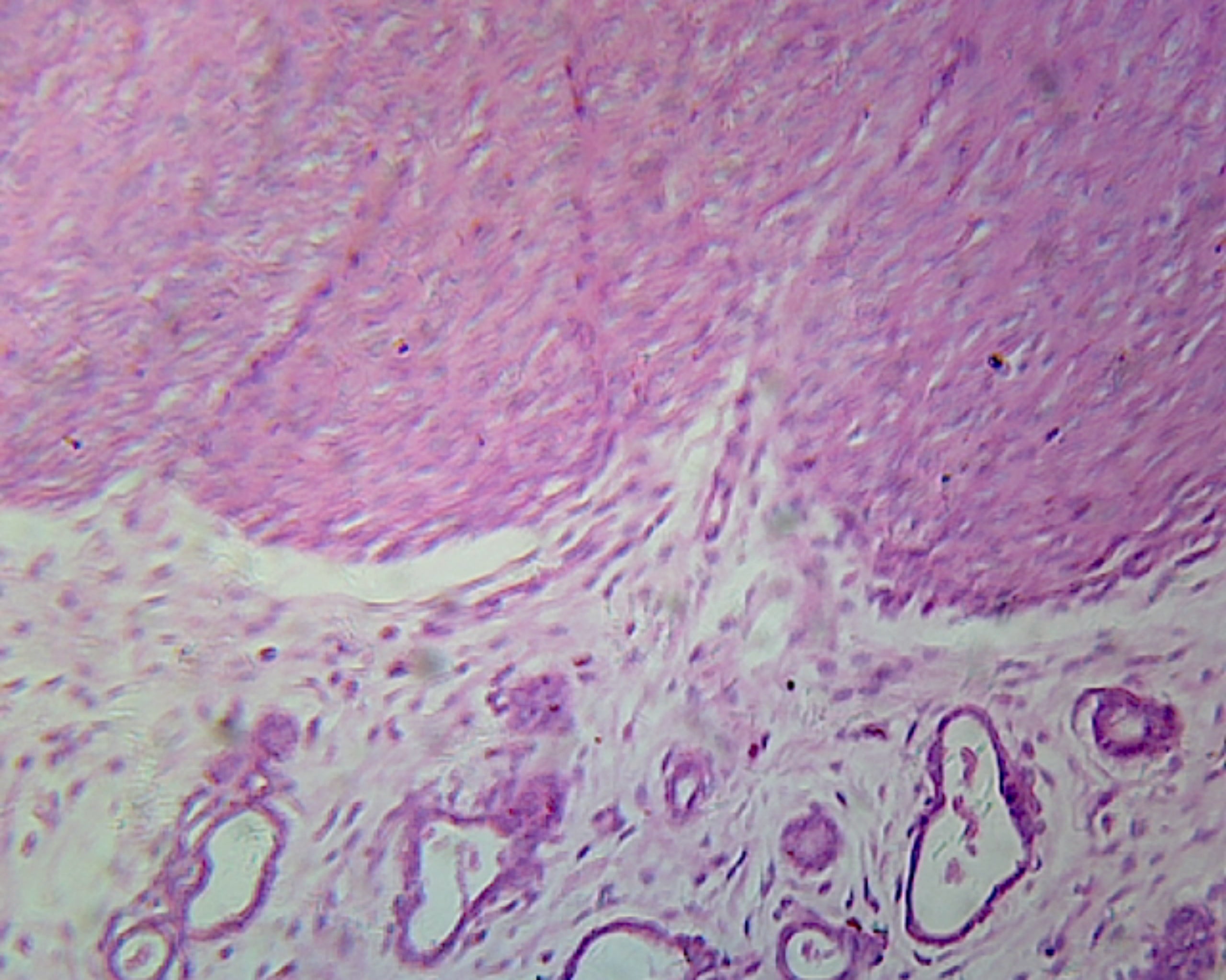 Cervix Uteri, Mammalian; Showing columnar epithelium; Section