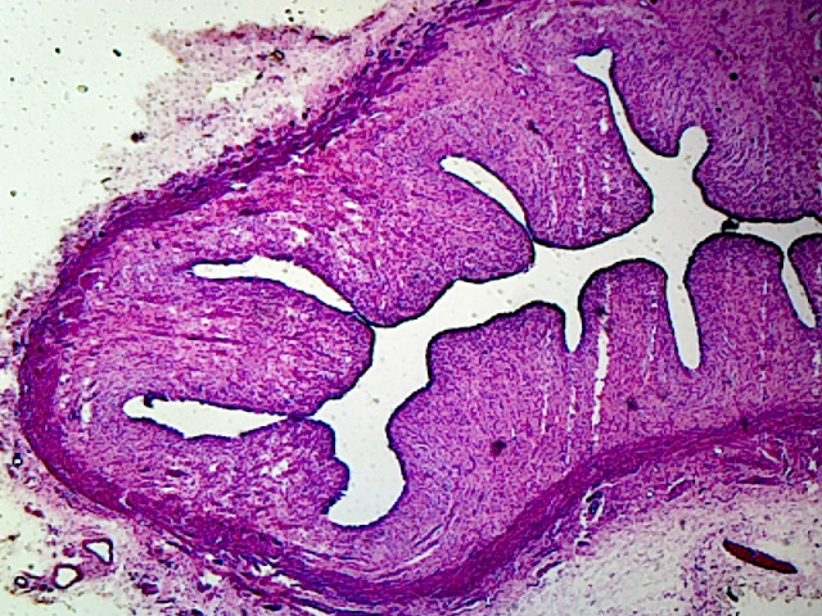 Vagina, Mammalian; Showing Cornified Squamous Epithelium; Section