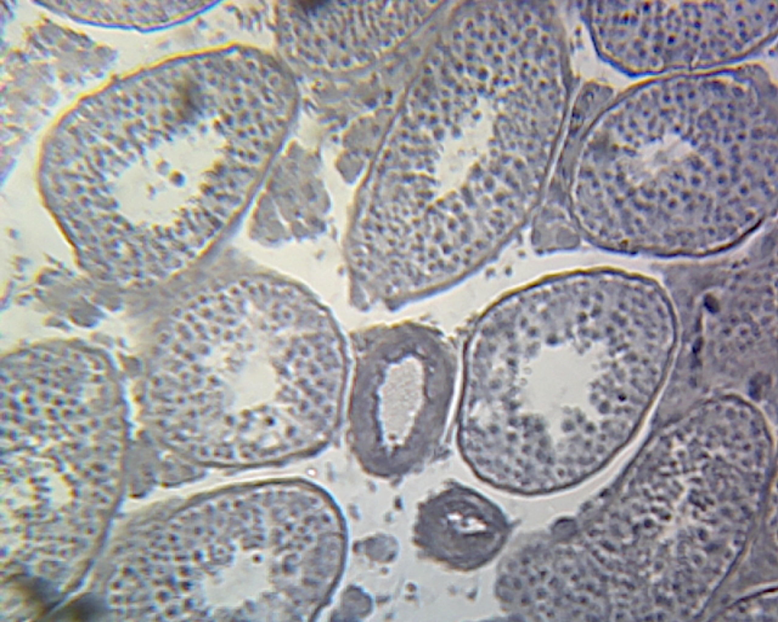 Seminal Vesicle, Mammalian; Section; H&E Stain