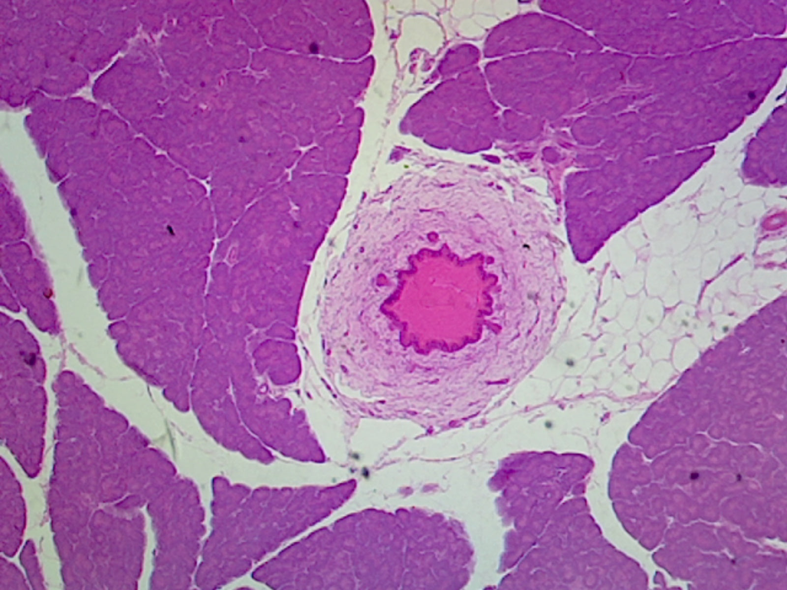 Pancreas Islets of Langerhans, Mammalian; Section by Go Science Crazy