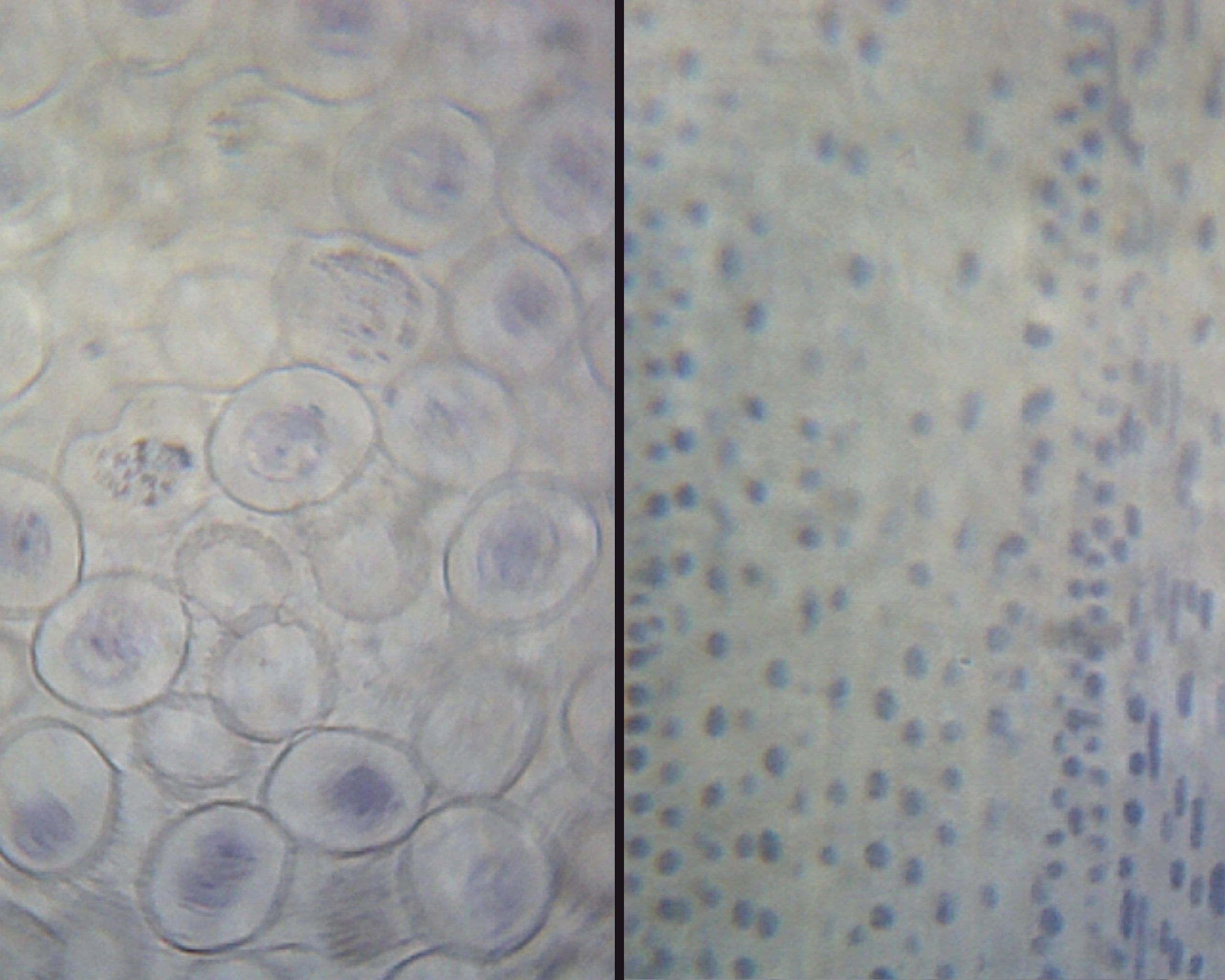 Slide, Ascaris and Onion Mitosis; Section