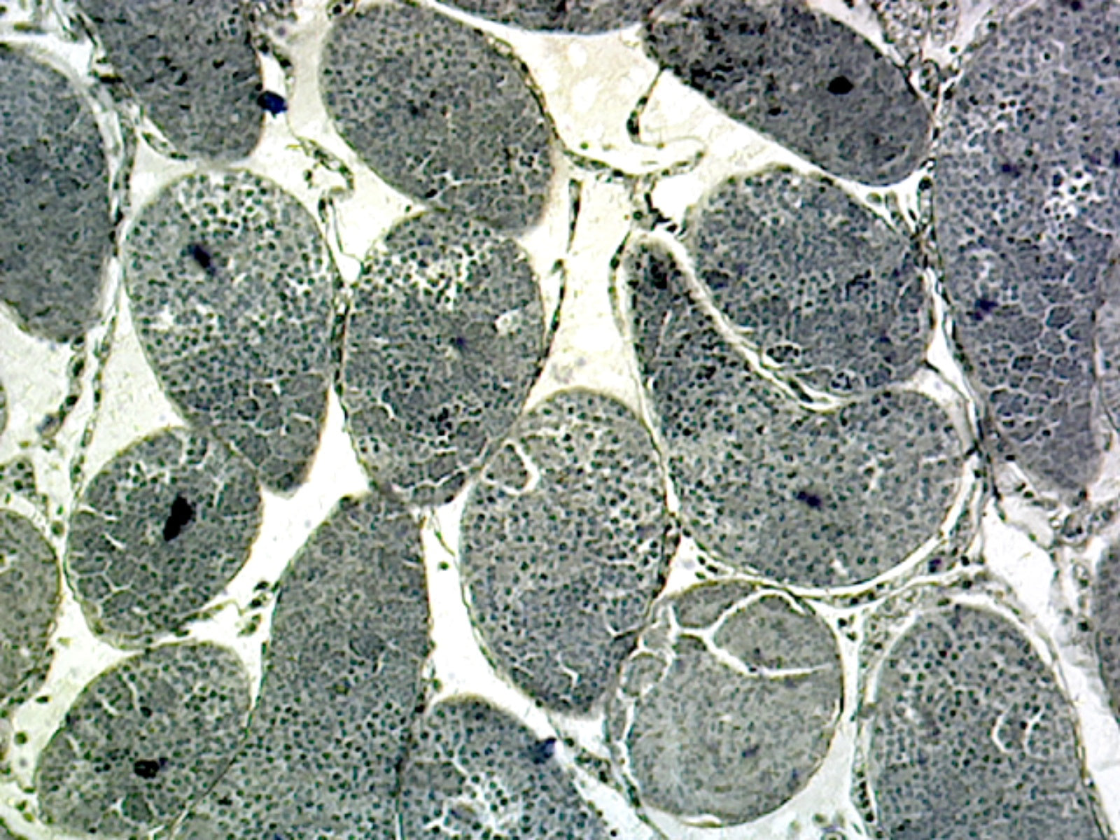 Grasshopper Meiosis; Section