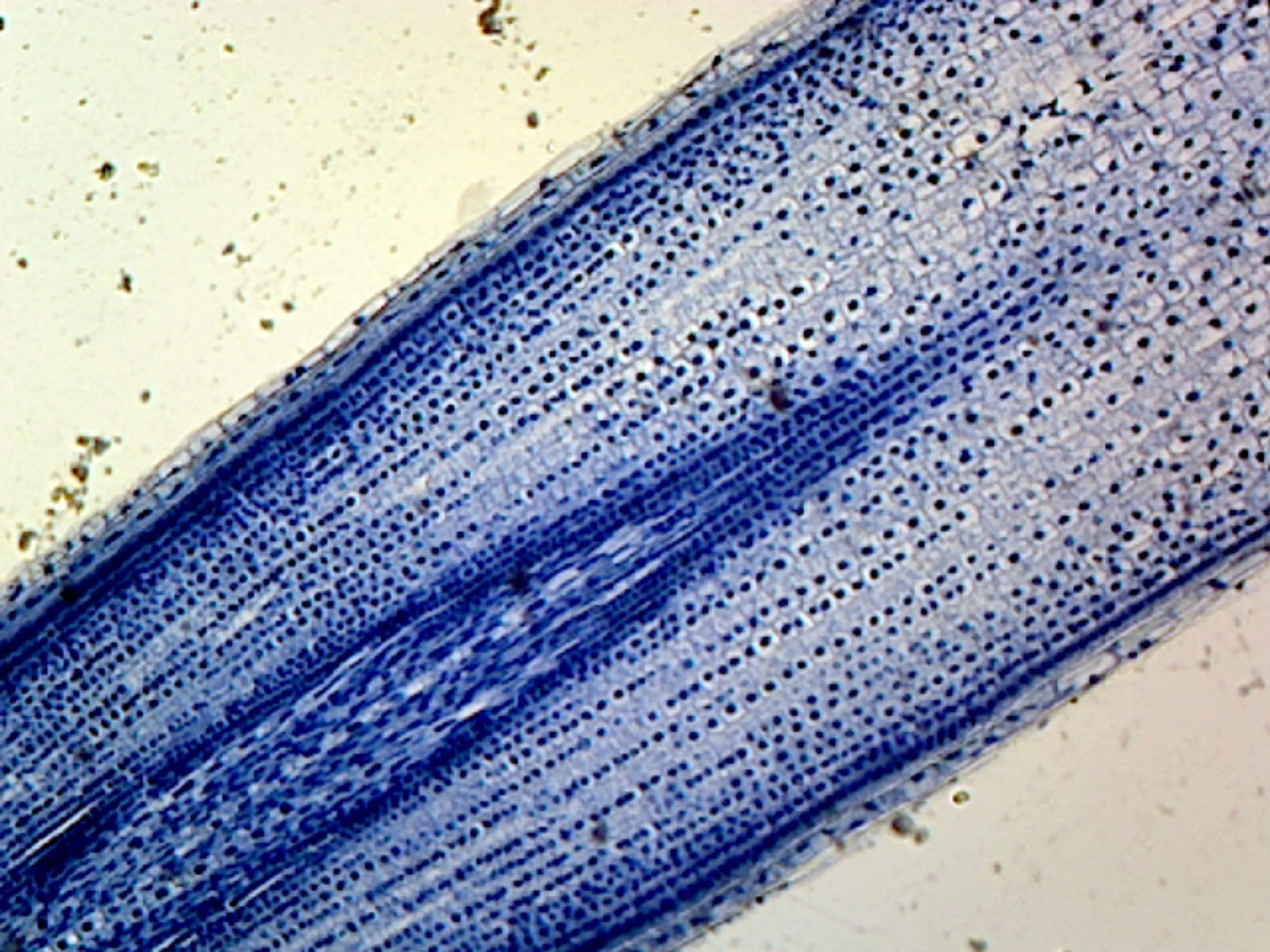Mitochondria, from Zea Maiz or Onion Epidermis; Section