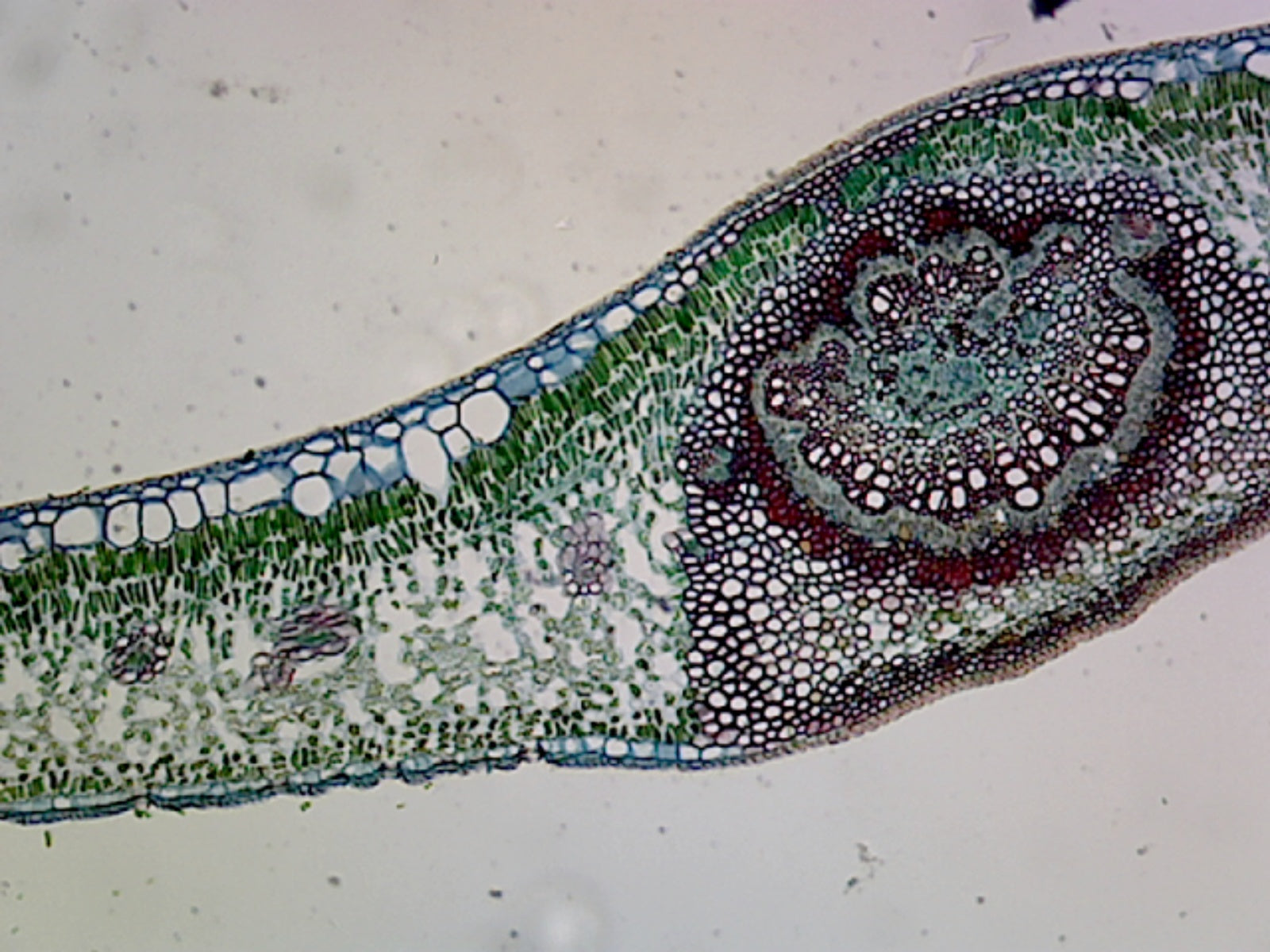 Chloroplasts, from Leaf of Plant; Section