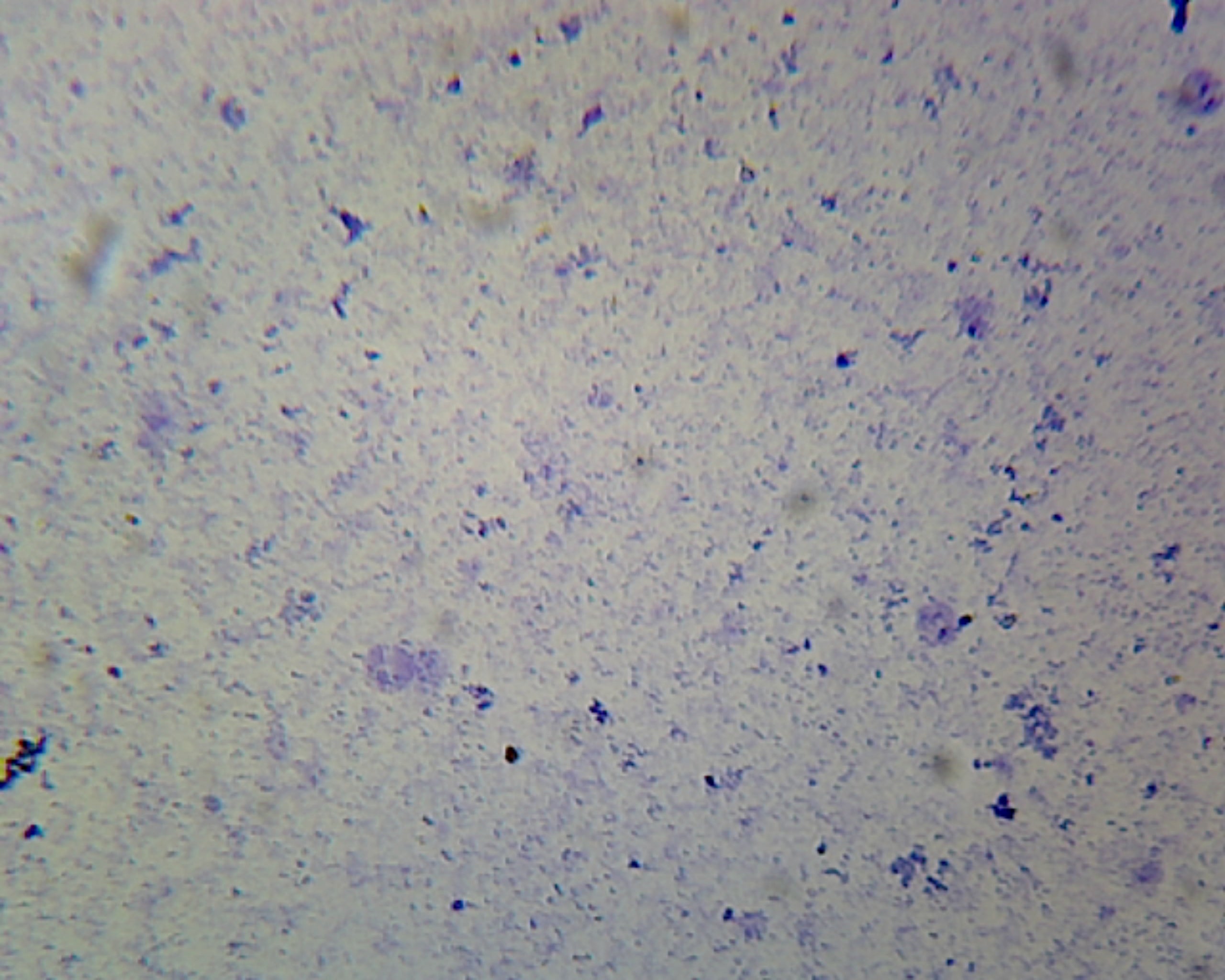 Coccus; Smear; Gram-Positive