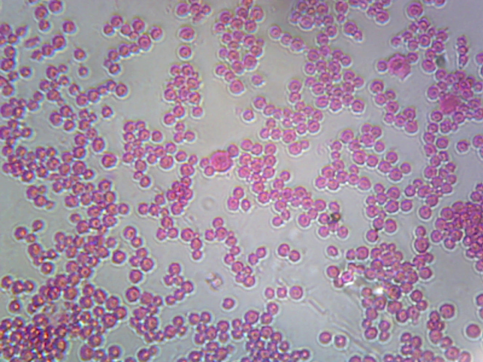 Meningococcus (Neisseria Meningitidis); Smear; Gram-Negative by Go Science Crazy
