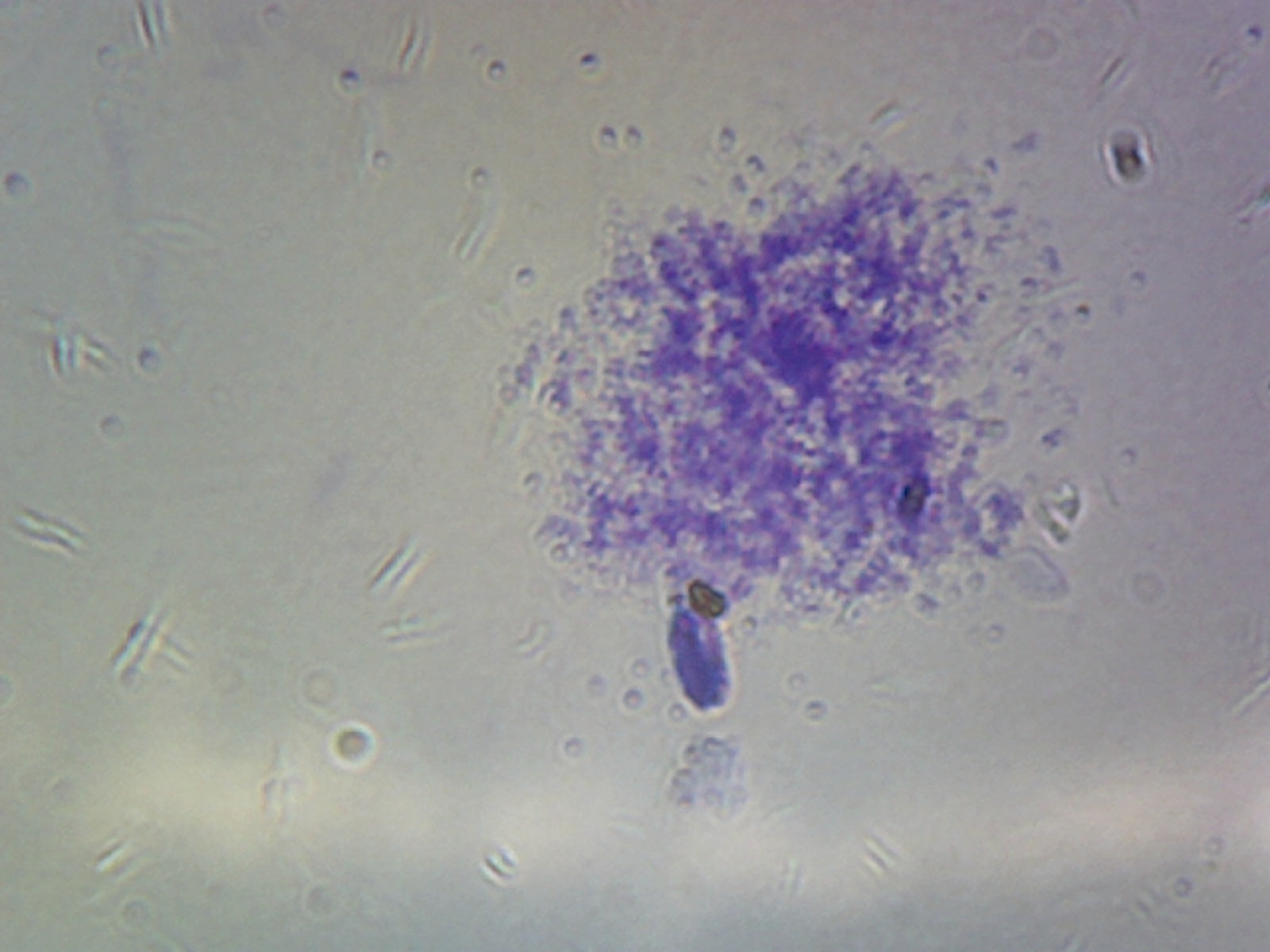 Staphylococcus Aureus; Smear; Gram-Positive
