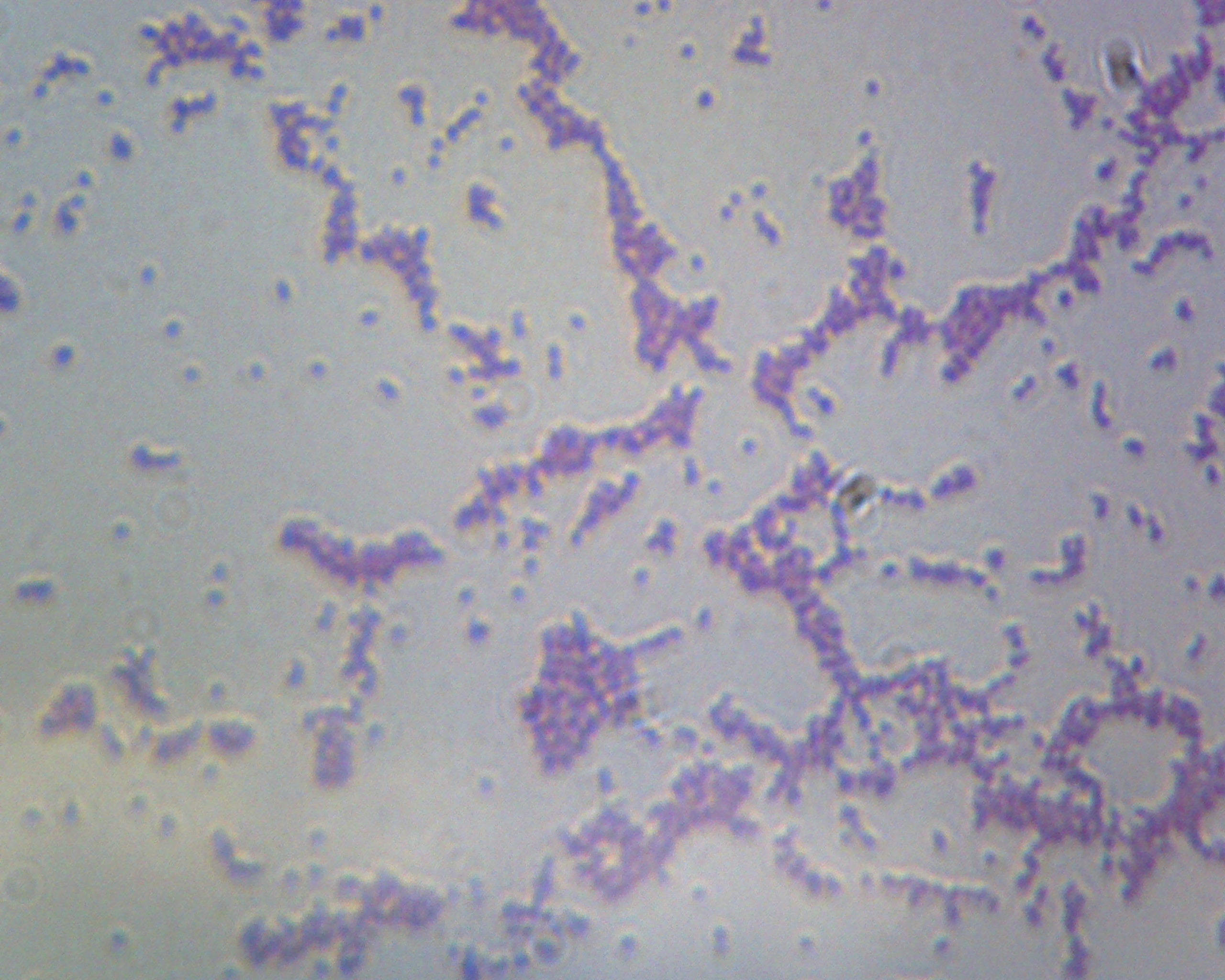 Bacillus; Smear; Gram-Negative by Go Science Crazy