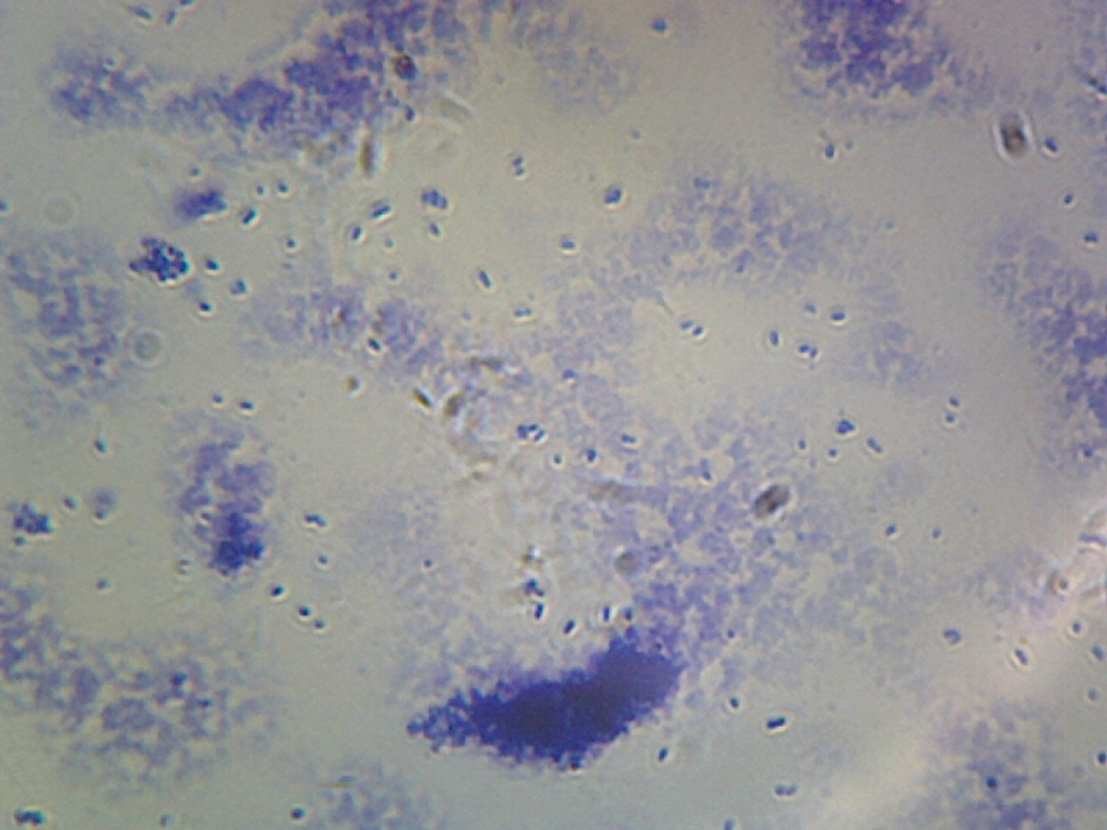 Clostridium Perfringens; Smear; Gram-Positive