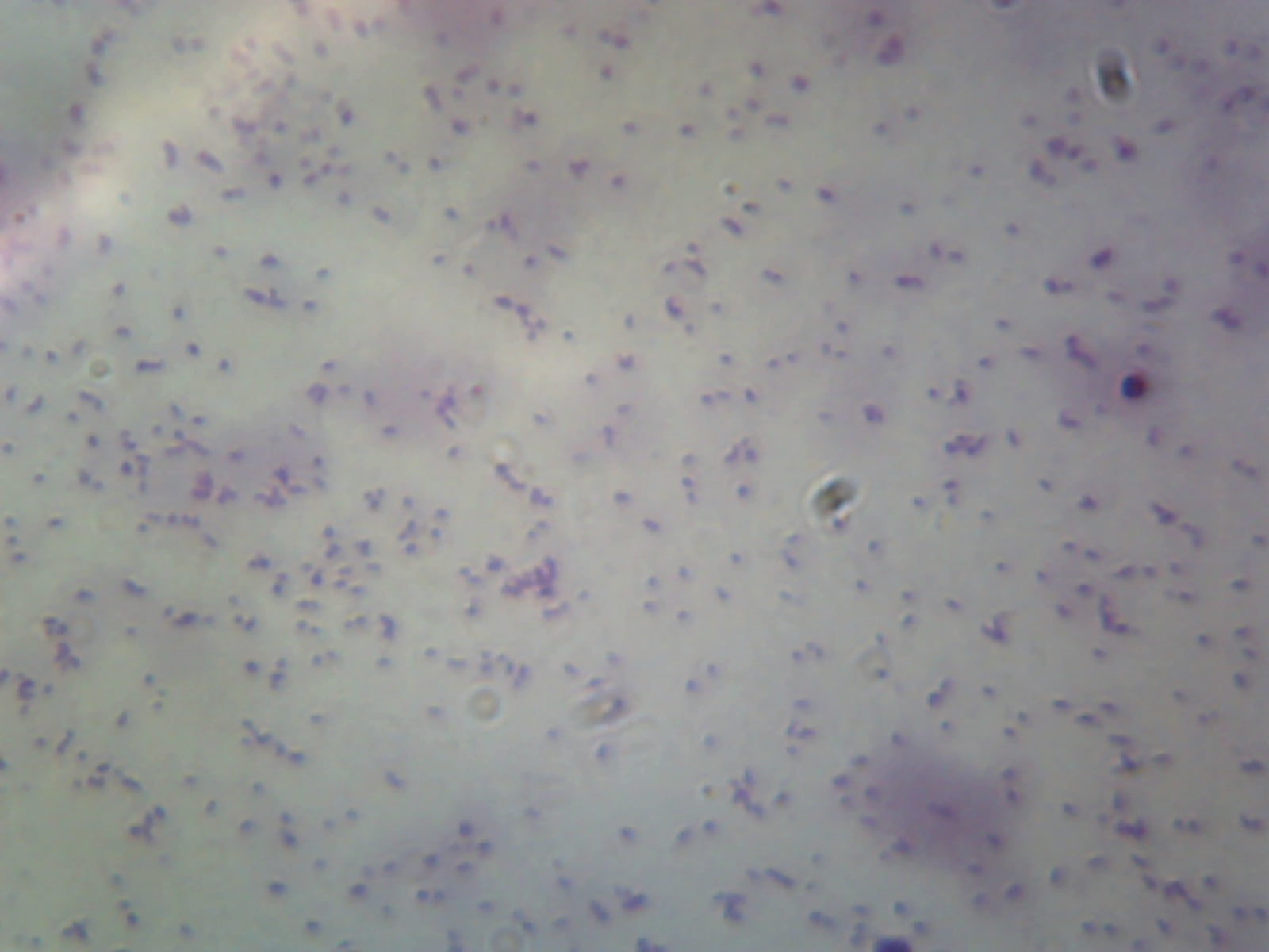 Salmonella Typhi; Smear; Gram-Negative