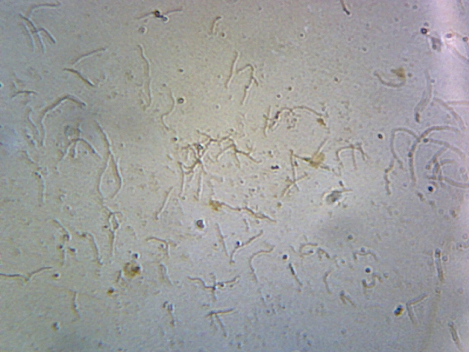 Leptospira (Spirochetes); Smear