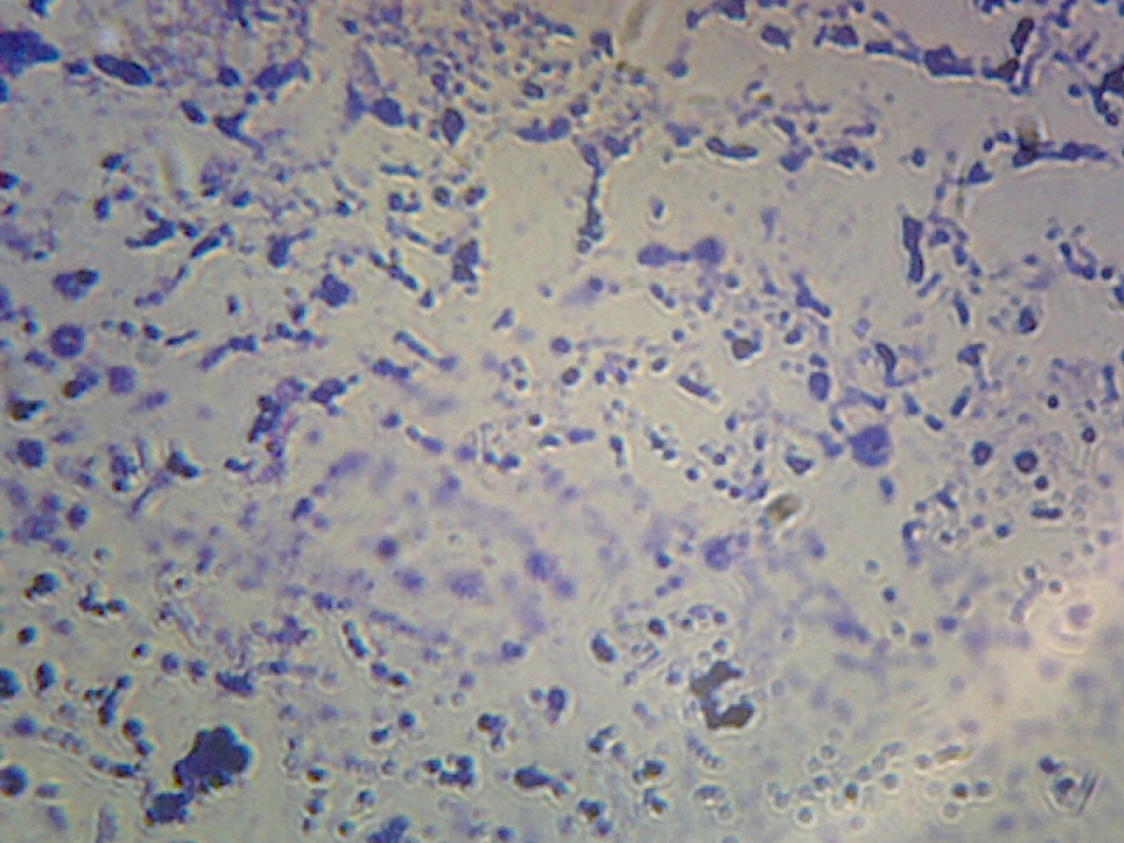 Clostridium Tetani, Spore-Forming Anaerobic Rods; Smear; Gram-Positive