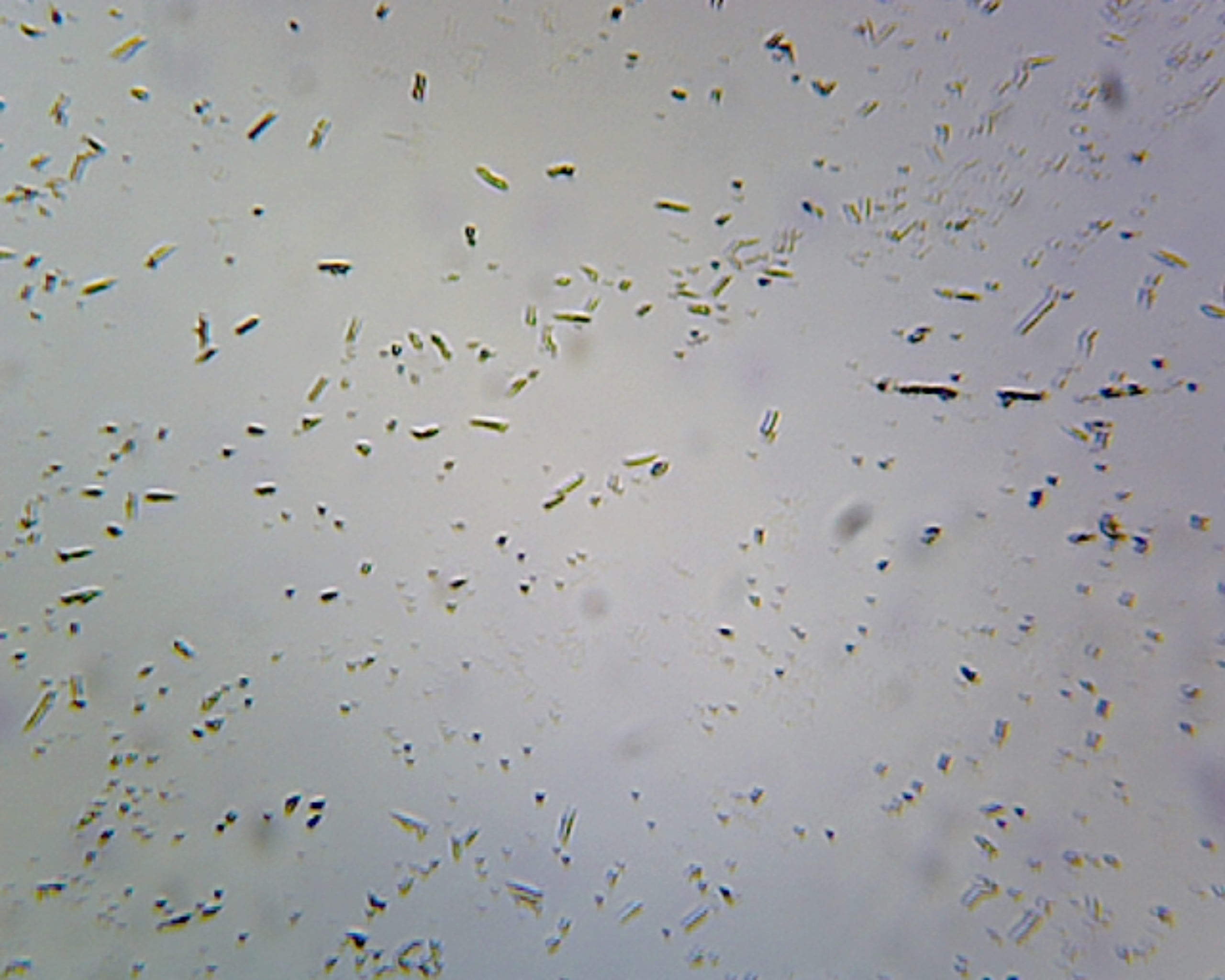 Clostridium Botulinum, Spore-Forming Anaerobic Rods; Smear; Gram-Positive