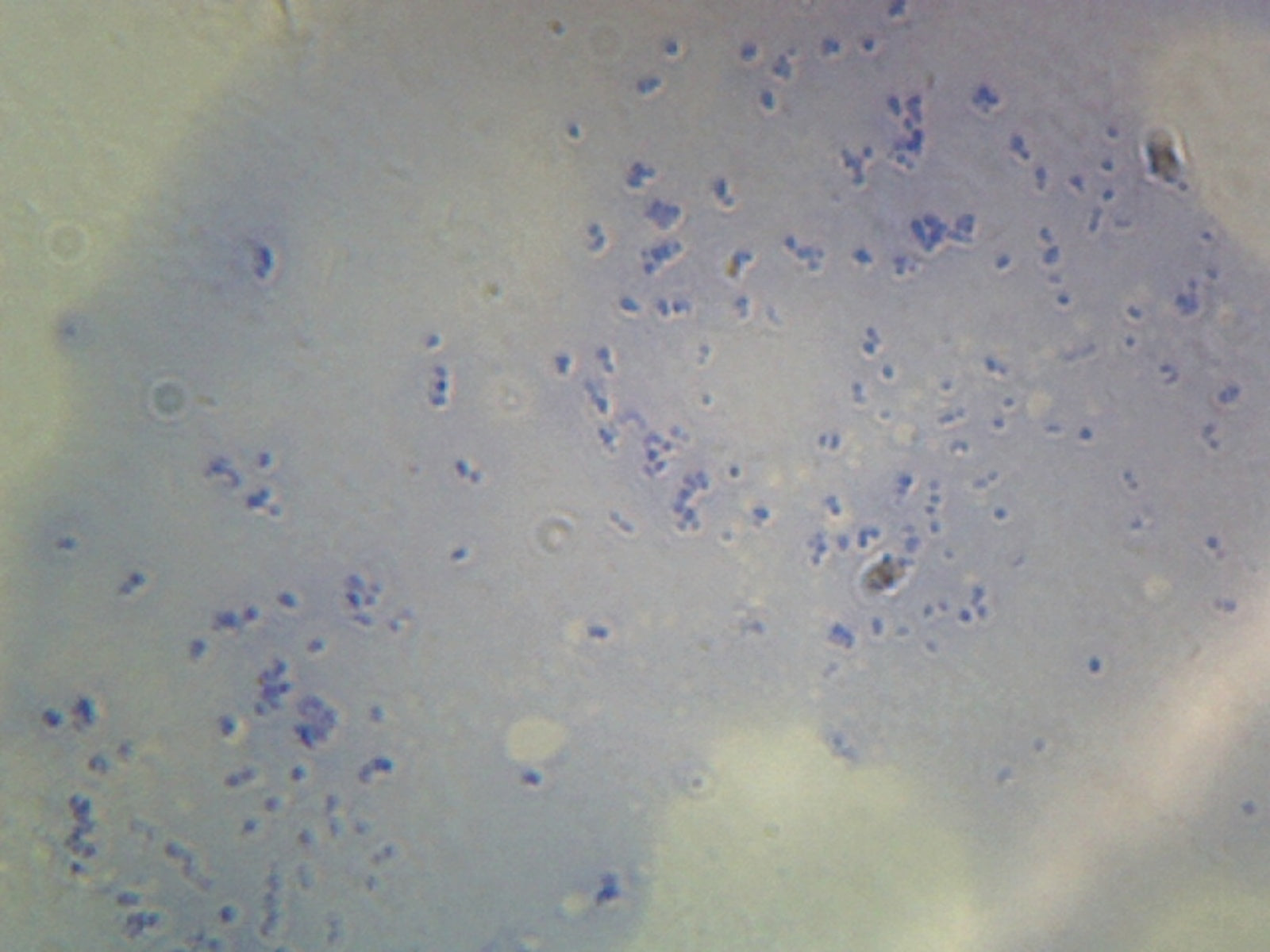 Lactobacillus Acidophilus, Rod-Shaped; Smear; Gram-Positive