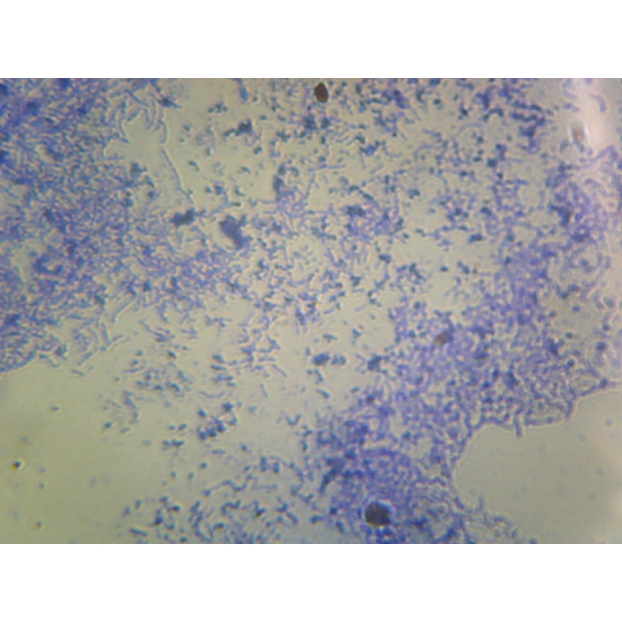 Lactobacillus Casei, Lactic Acid Producer; Smear; Gram-Positive