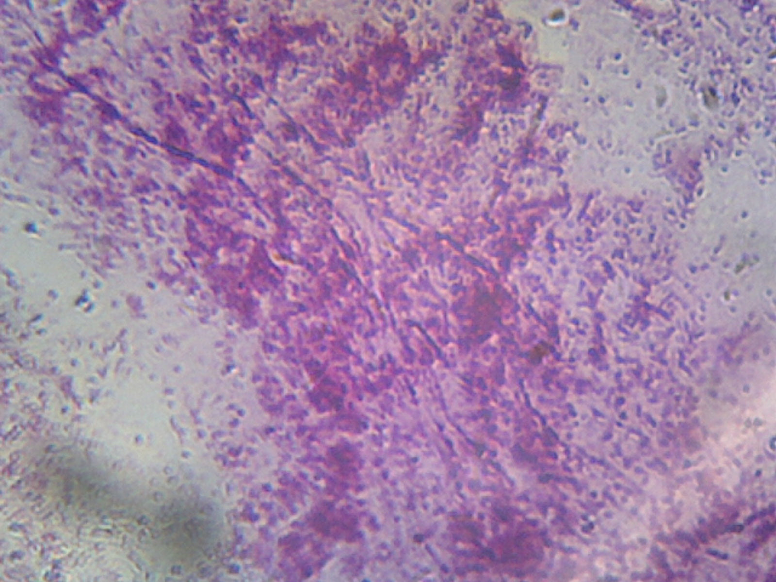 Pseudomonas Aeruginosa; Smear; Gram-Negative