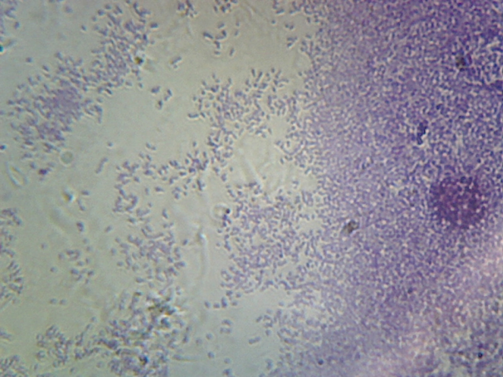 Proteus Vulgaris; Smear; Gram-Negative